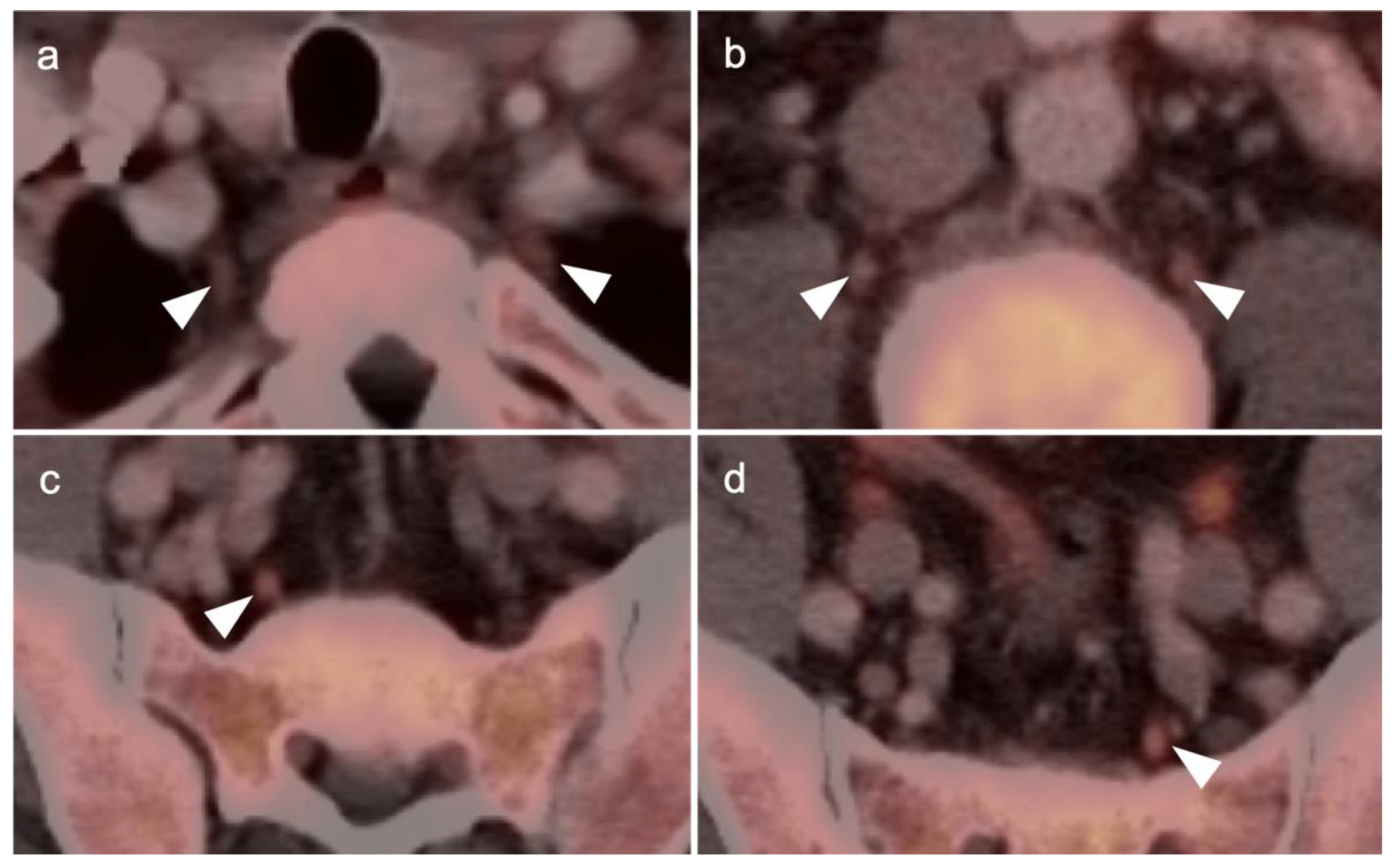 Cancers 14 03000 g035 Cancers 14 03000 g035