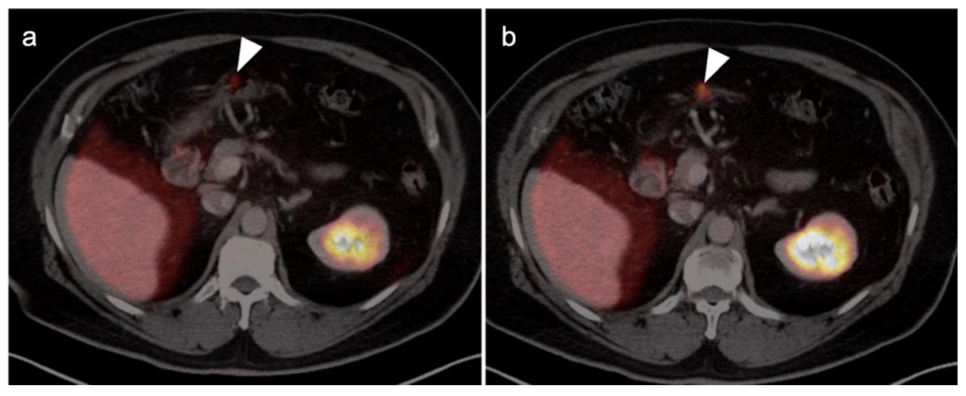 Cancers 14 03000 g036 Cancers 14 03000 g036