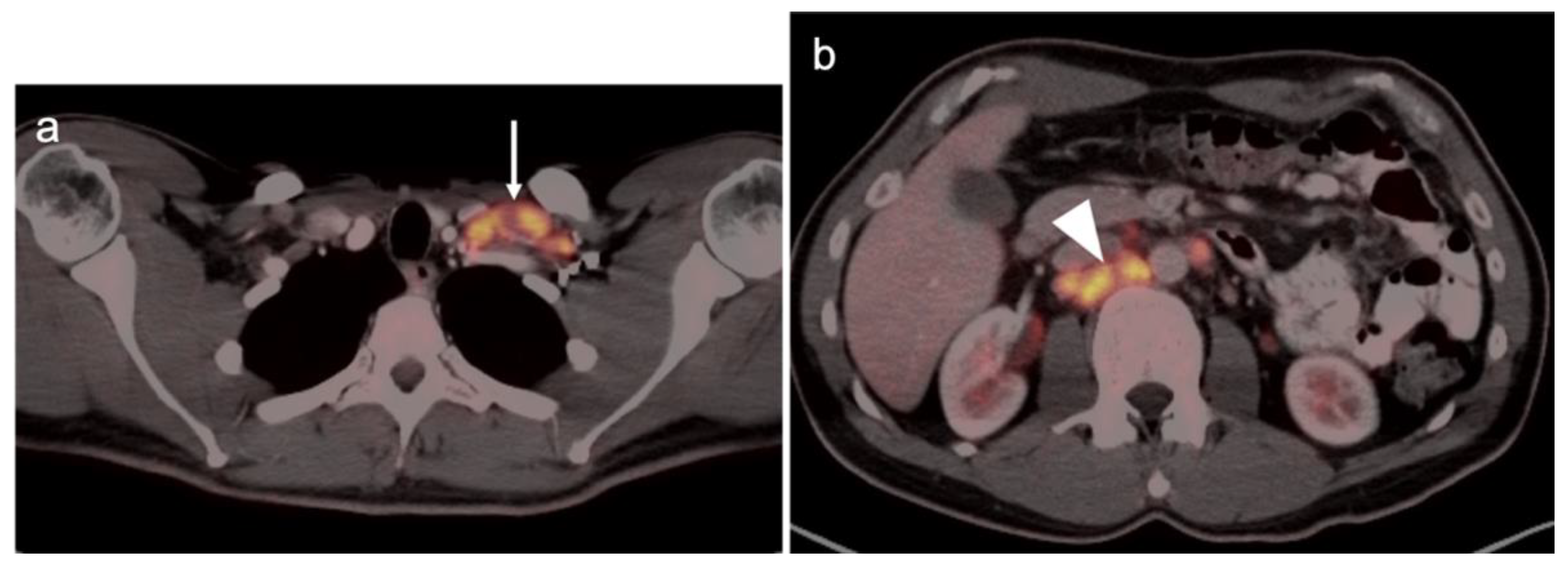 Cancers 14 03000 g045 Cancers 14 03000 g045