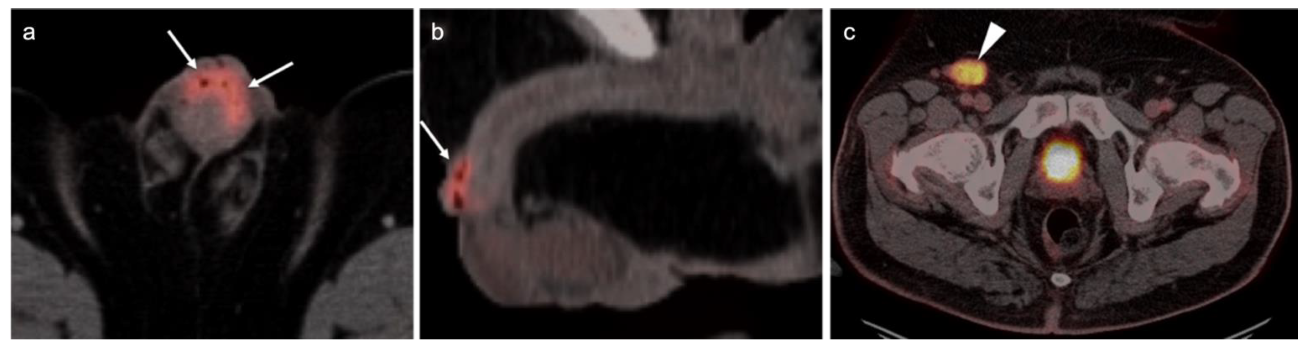 Cancers 14 03000 g052 Cancers 14 03000 g052