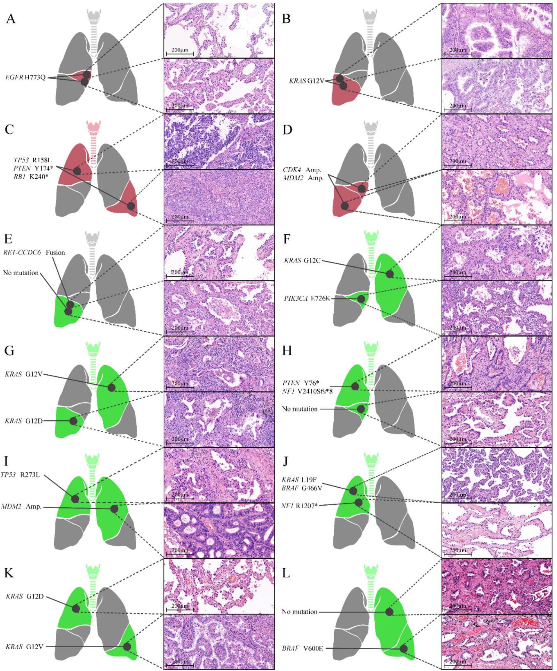 Cancers 14 03011 g002 Cancers 14 03011 g002