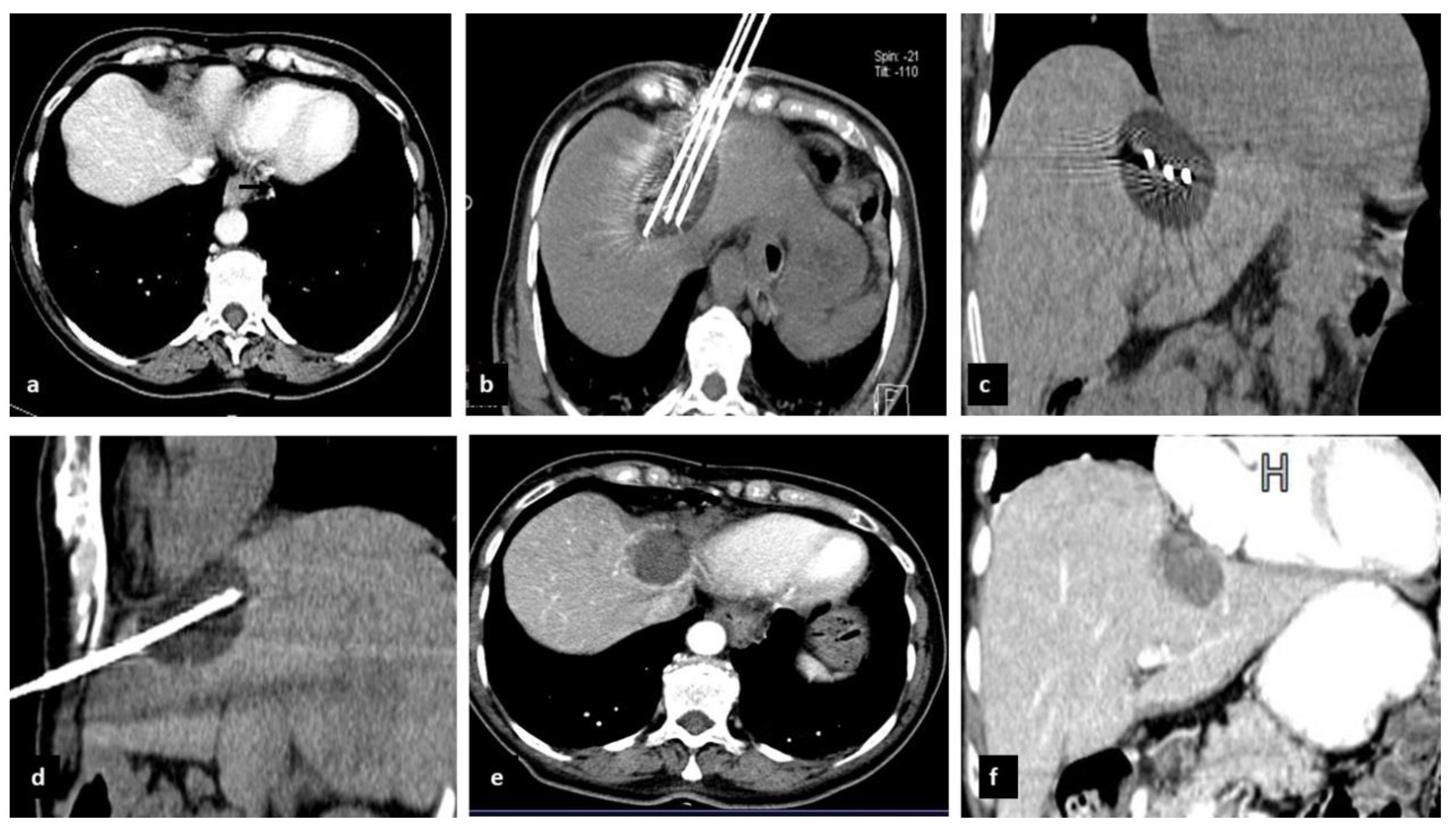 Cancers 14 03018 g002