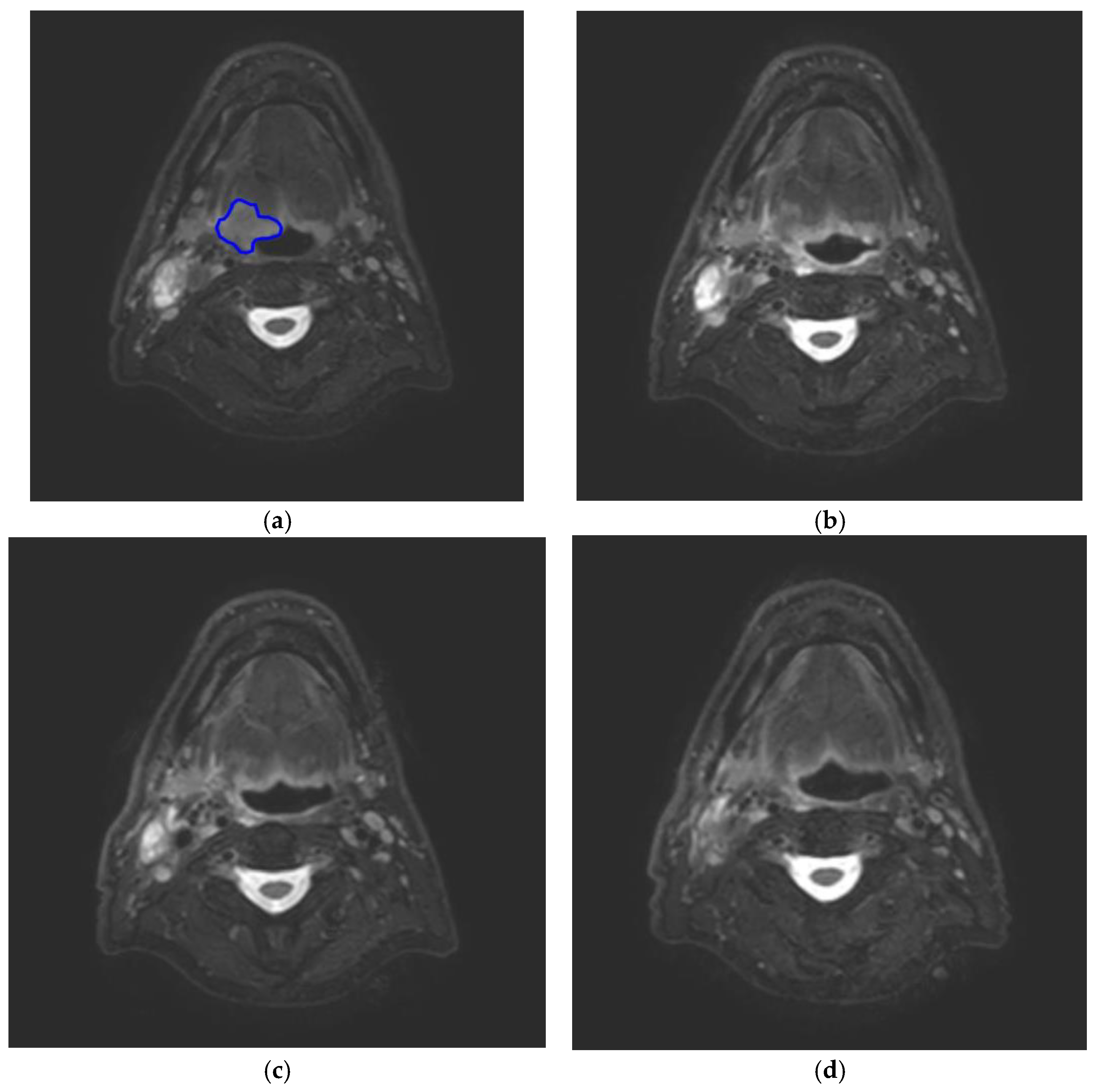 Cancers 14 03027 g002 550