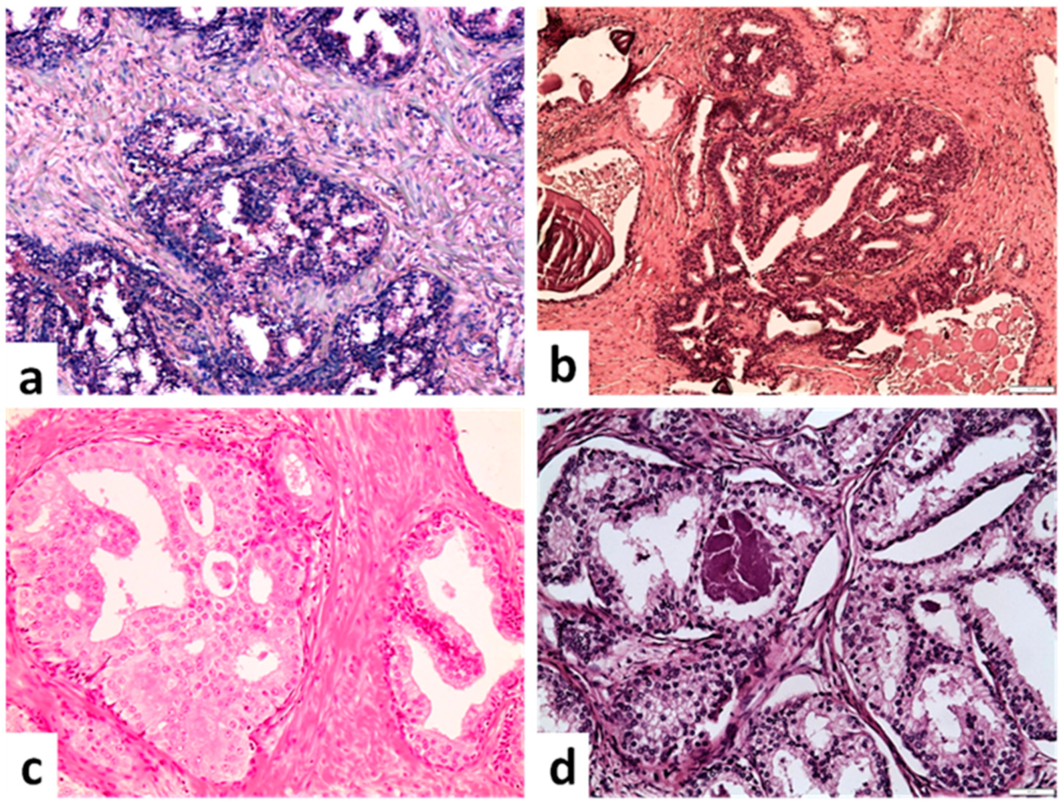 Cancers 14 03041 g001