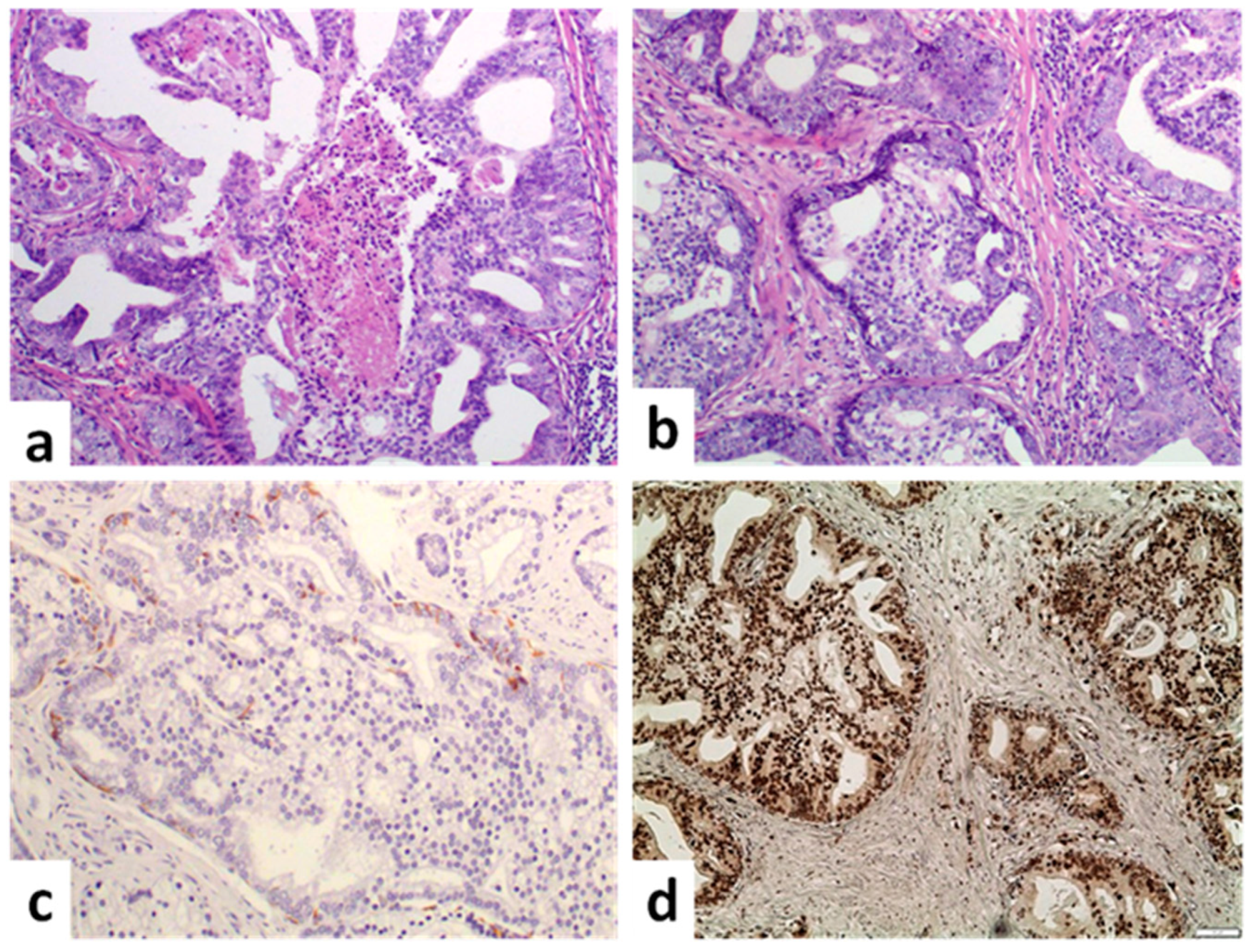 Cancers 14 03041 g003