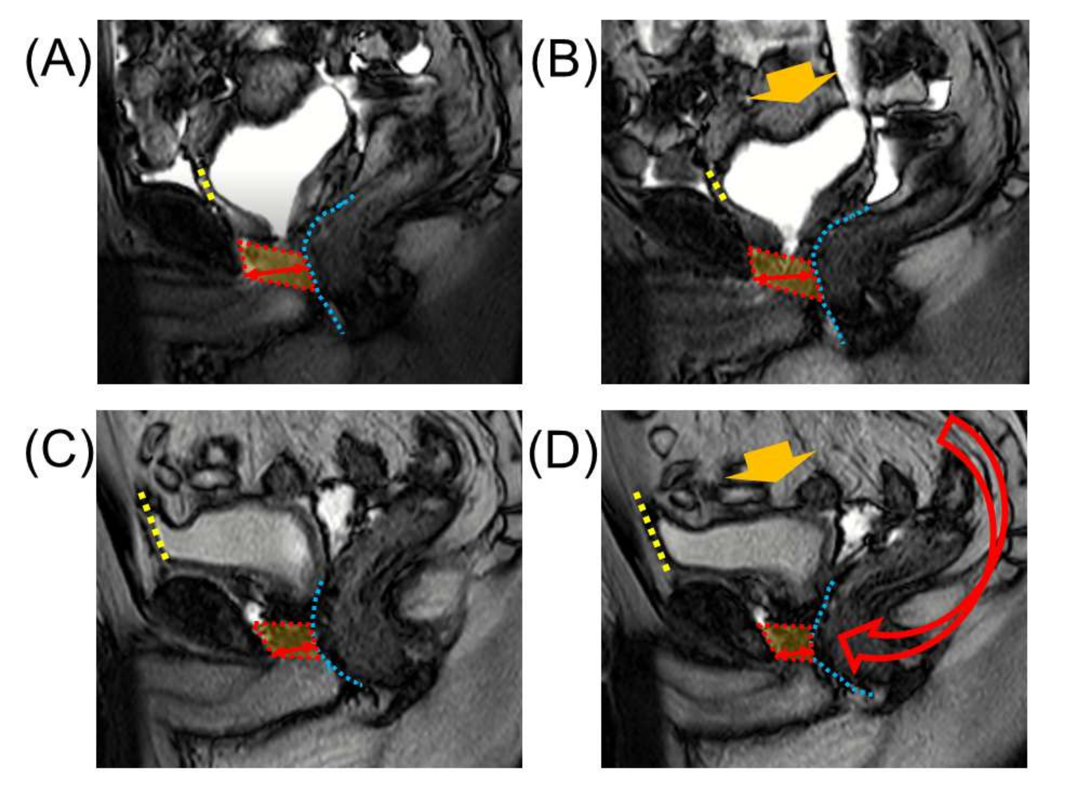 Cancers 14 03050 g003 Cancers 14 03050 g003