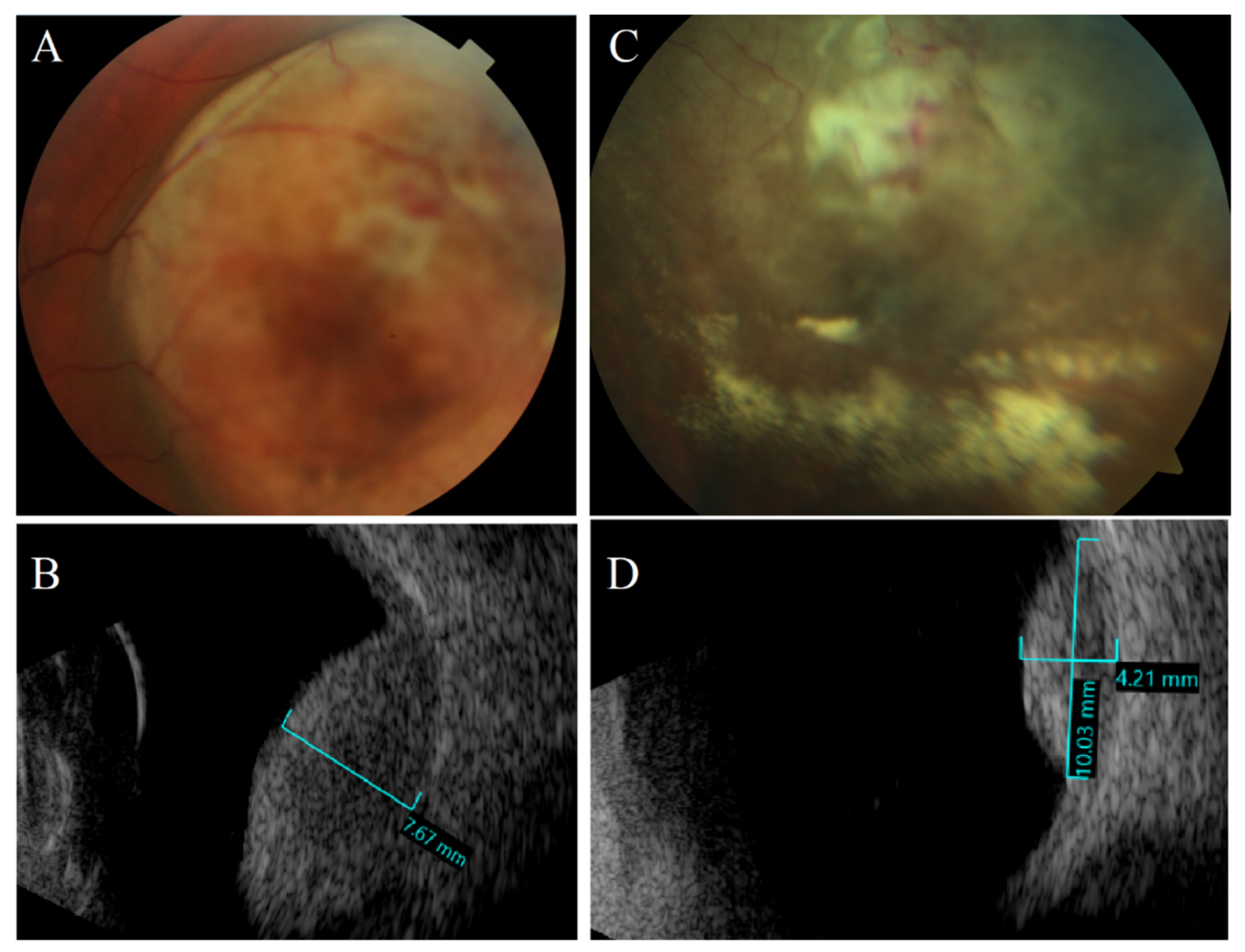 Cancers 14 03147 g004 Cancers 14 03147 g004