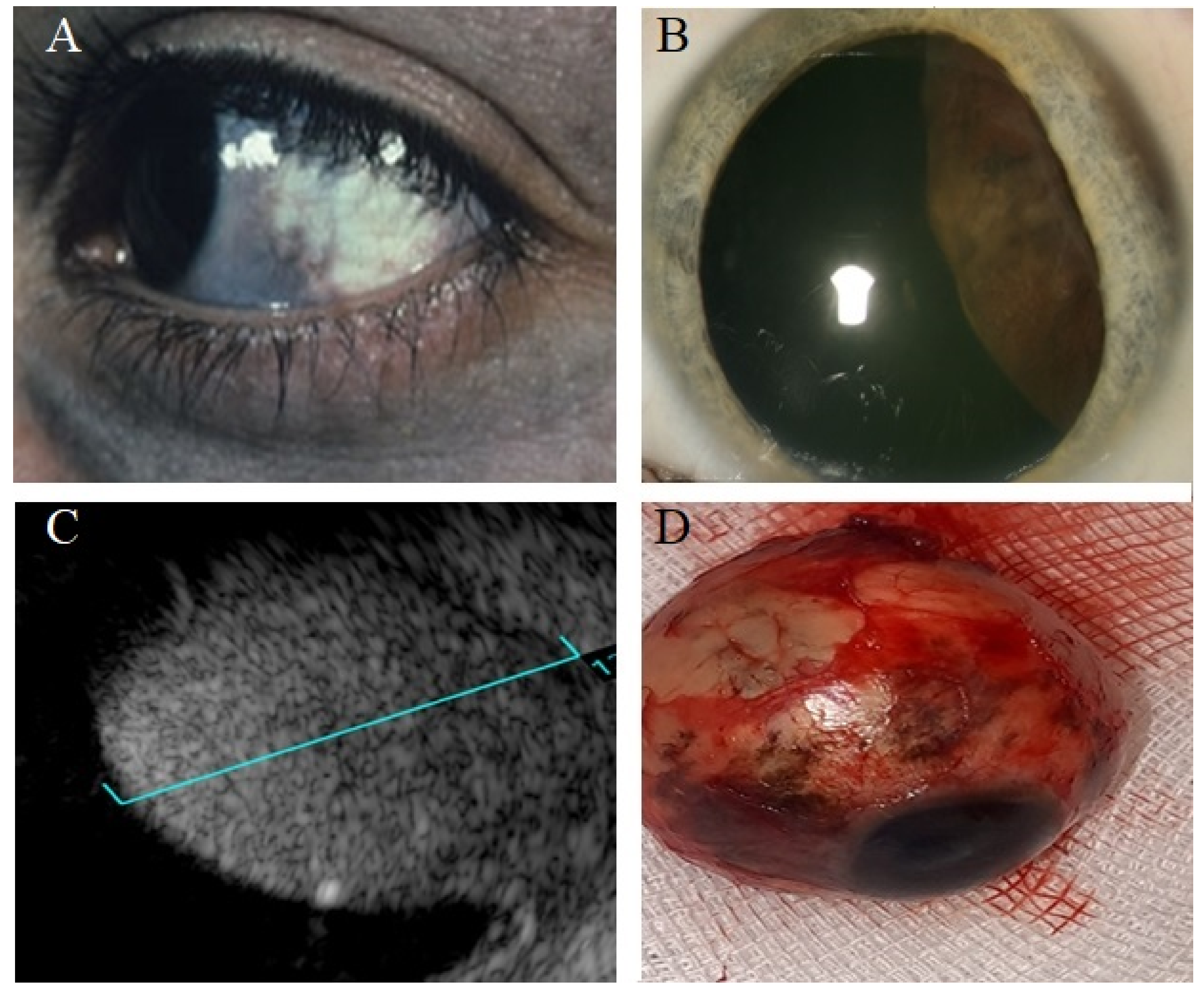 Cancers 14 03147 g005 Cancers 14 03147 g005