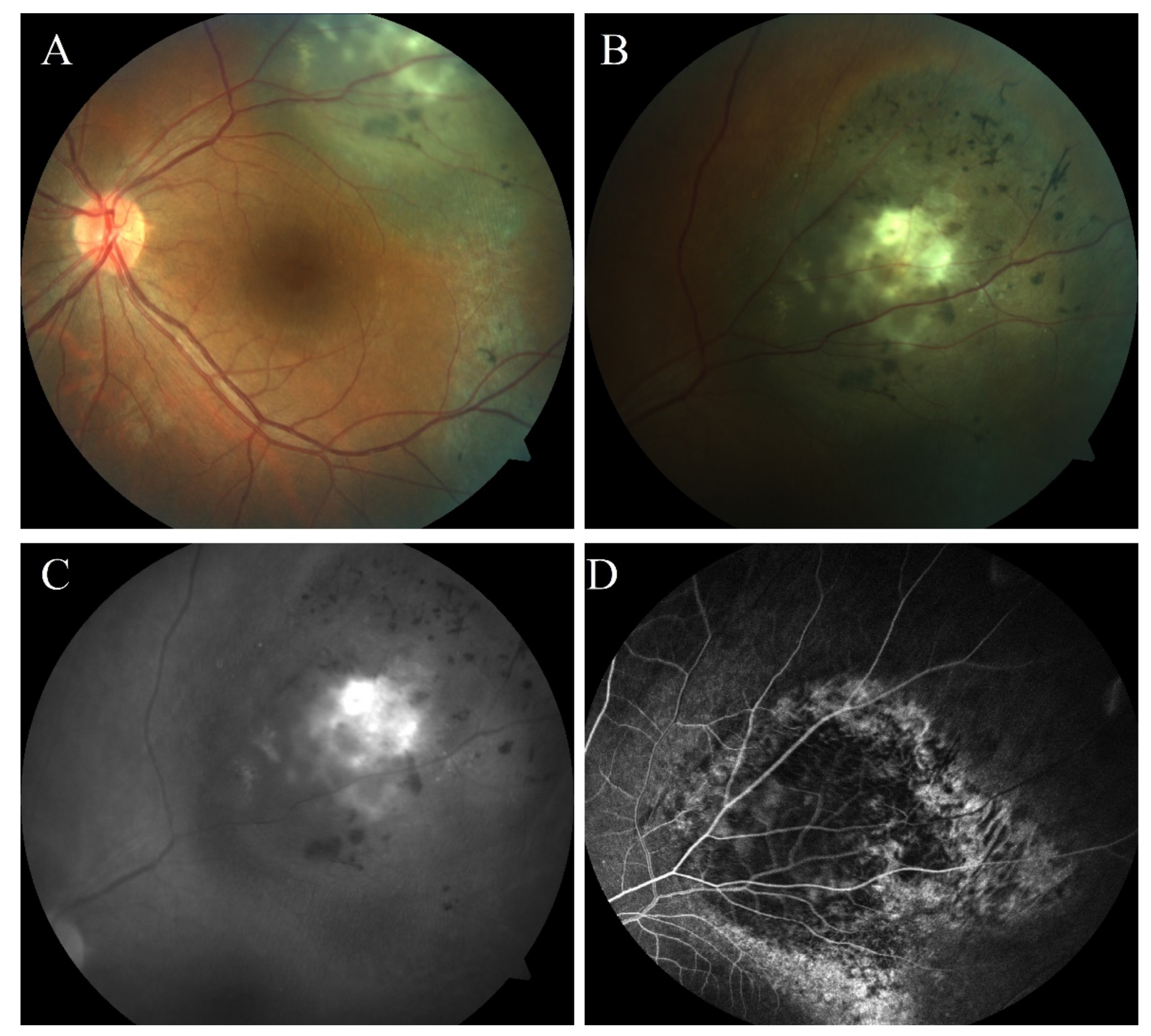 Cancers 14 03147 g006 Cancers 14 03147 g006