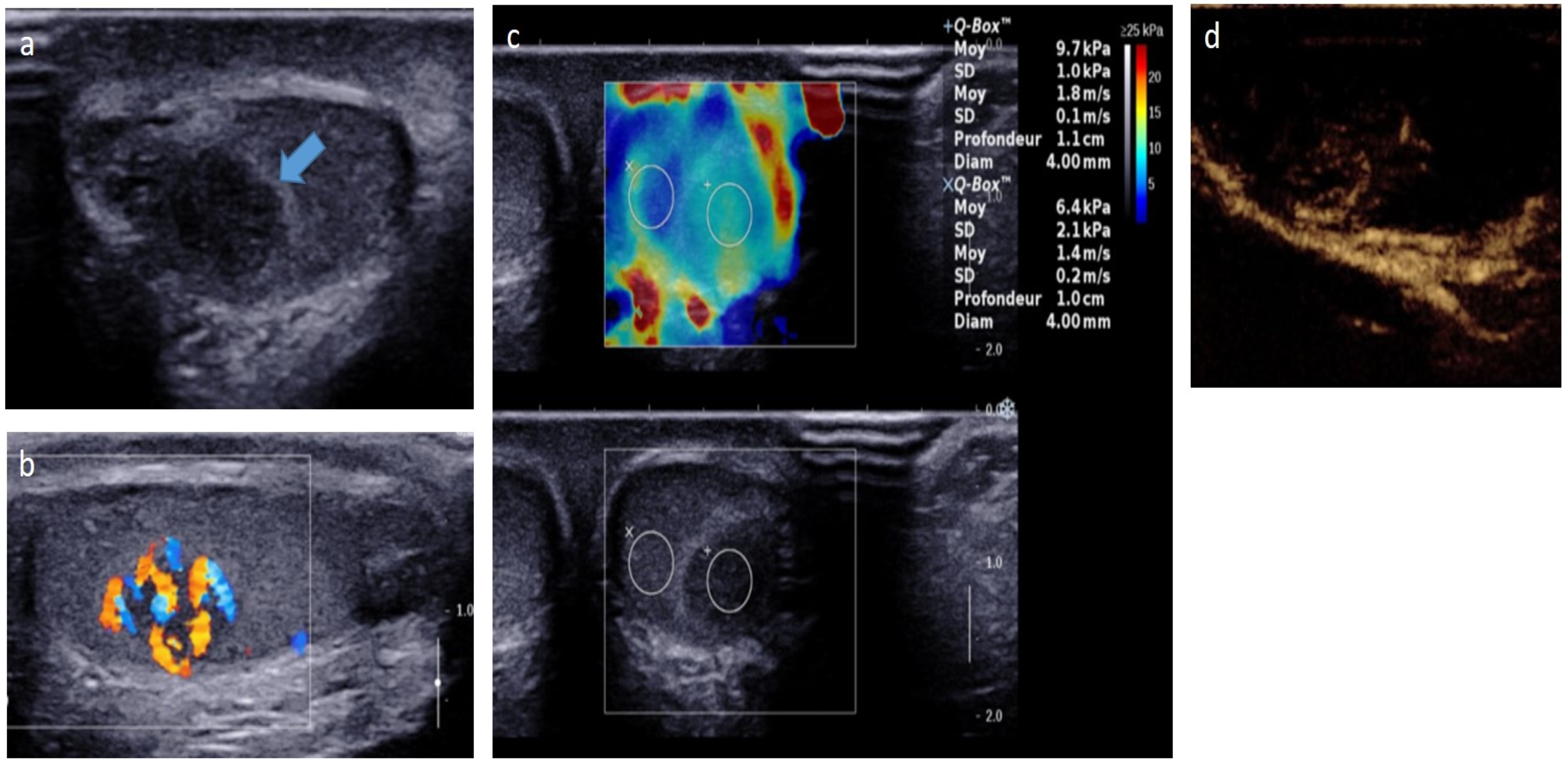 Cancers 14 03180 g005 Cancers 14 03180 g005