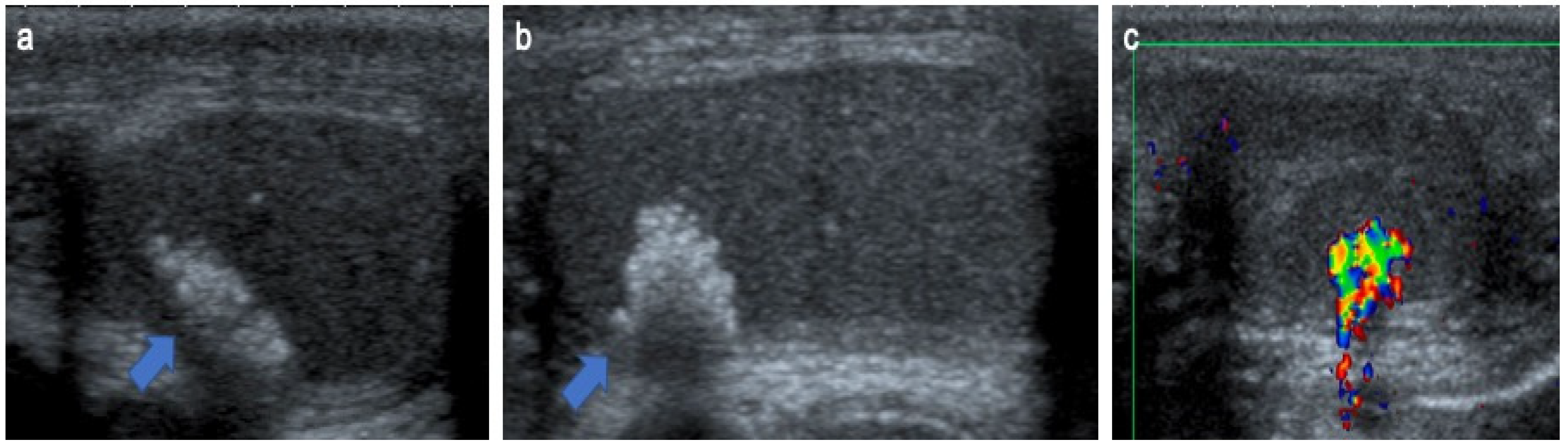 Cancers 14 03180 g006 Cancers 14 03180 g006