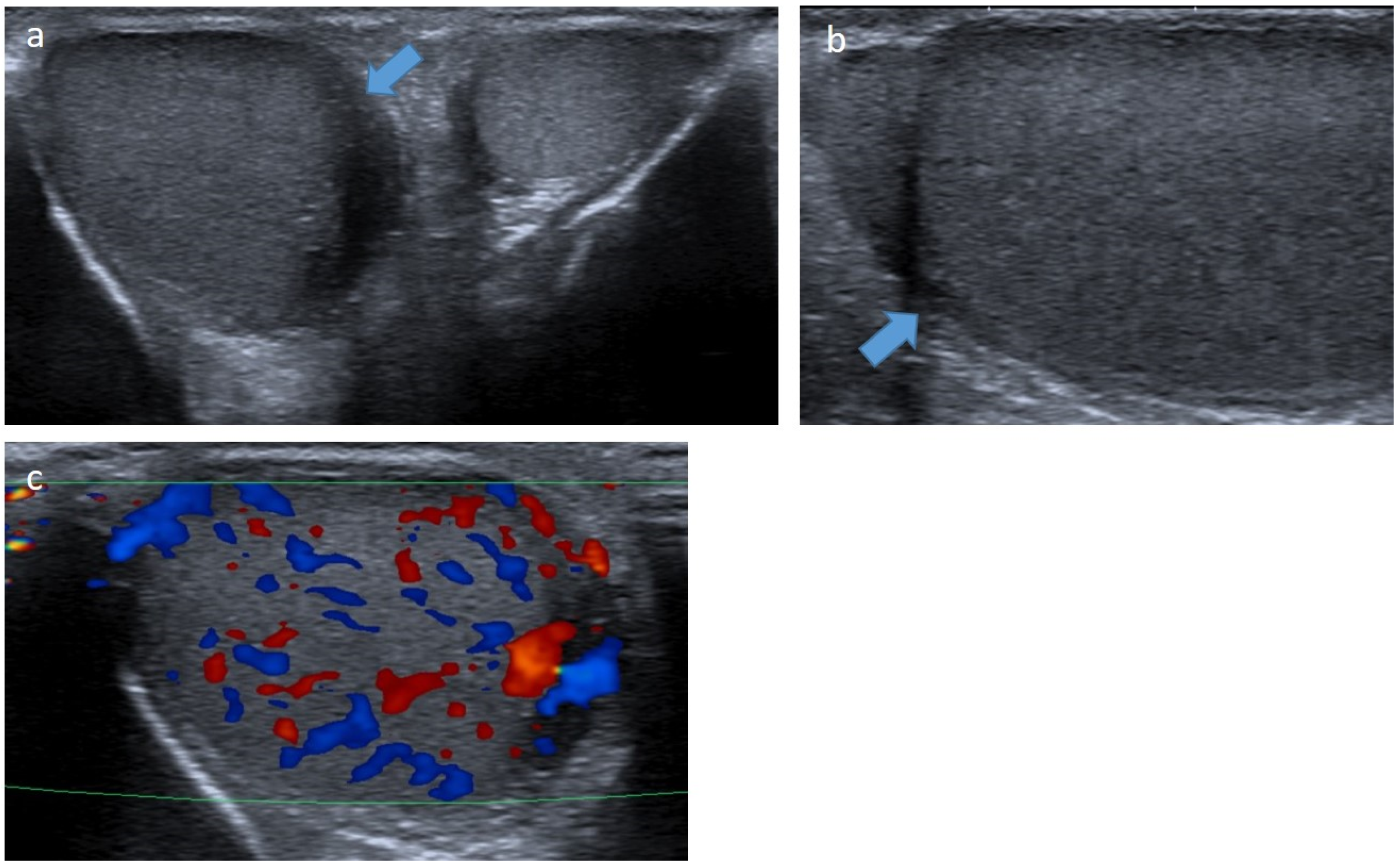Cancers 14 03180 g008 Cancers 14 03180 g008