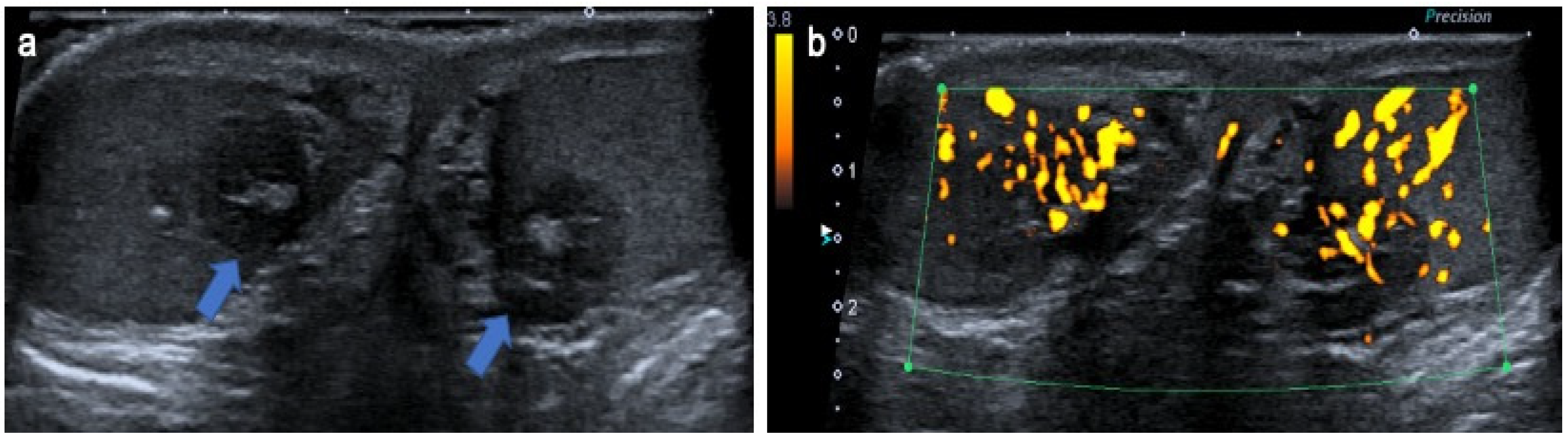 Cancers 14 03180 g010 Cancers 14 03180 g010