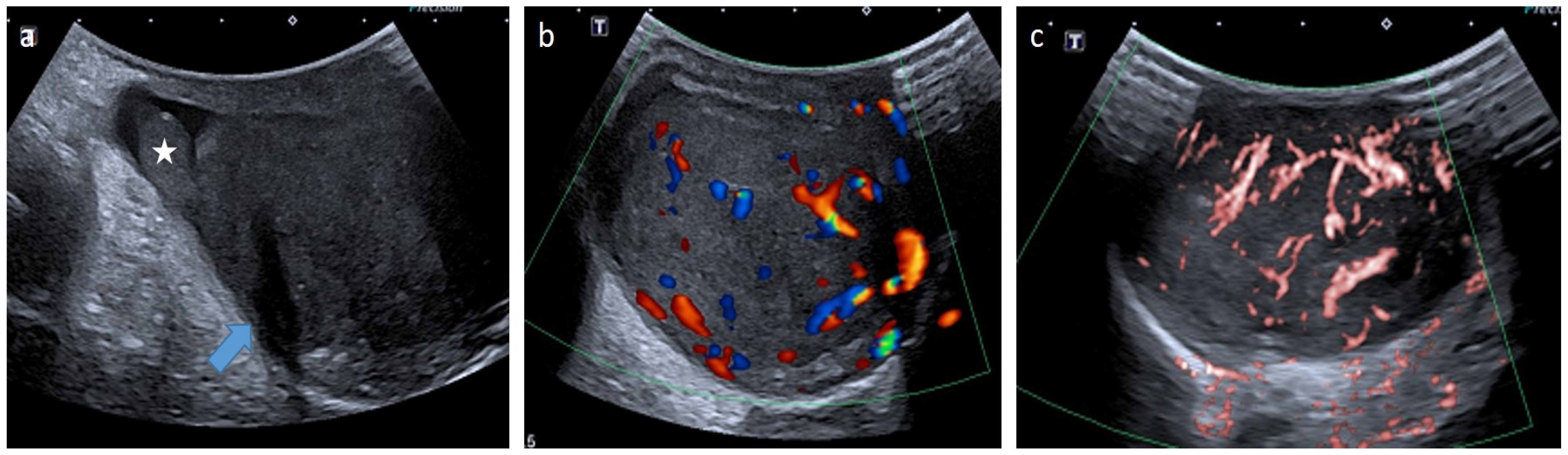 Cancers 14 03180 g013 Cancers 14 03180 g013