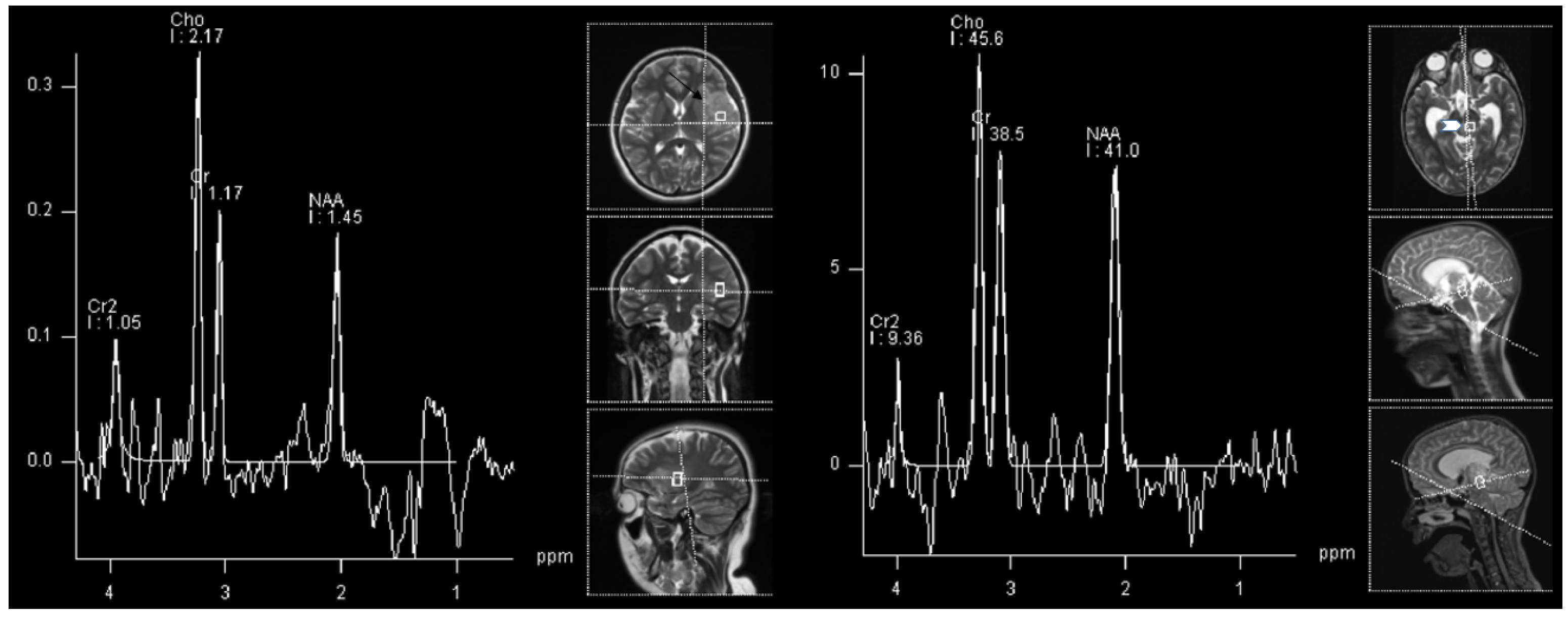 Cancers 14 03197 g002