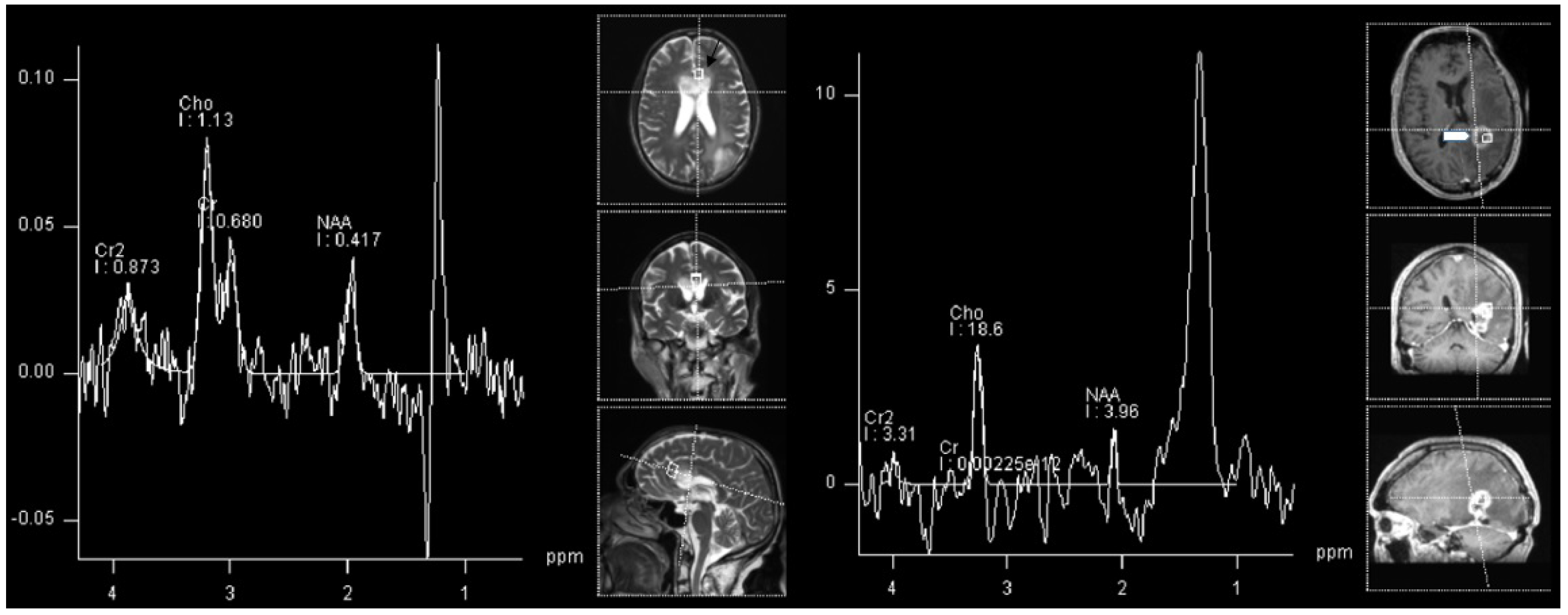 Cancers 14 03197 g004