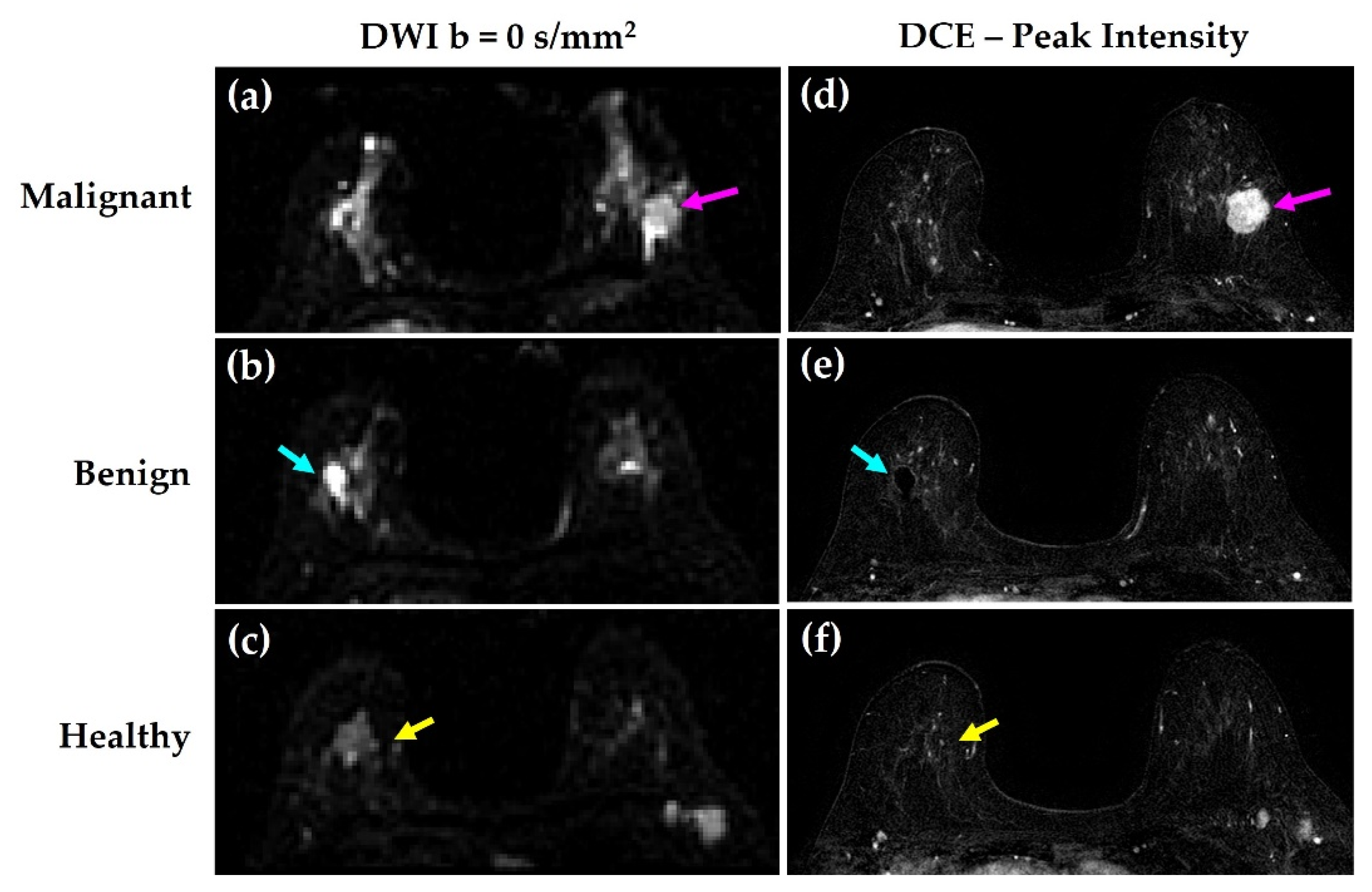 Cancers 14 03200 g002