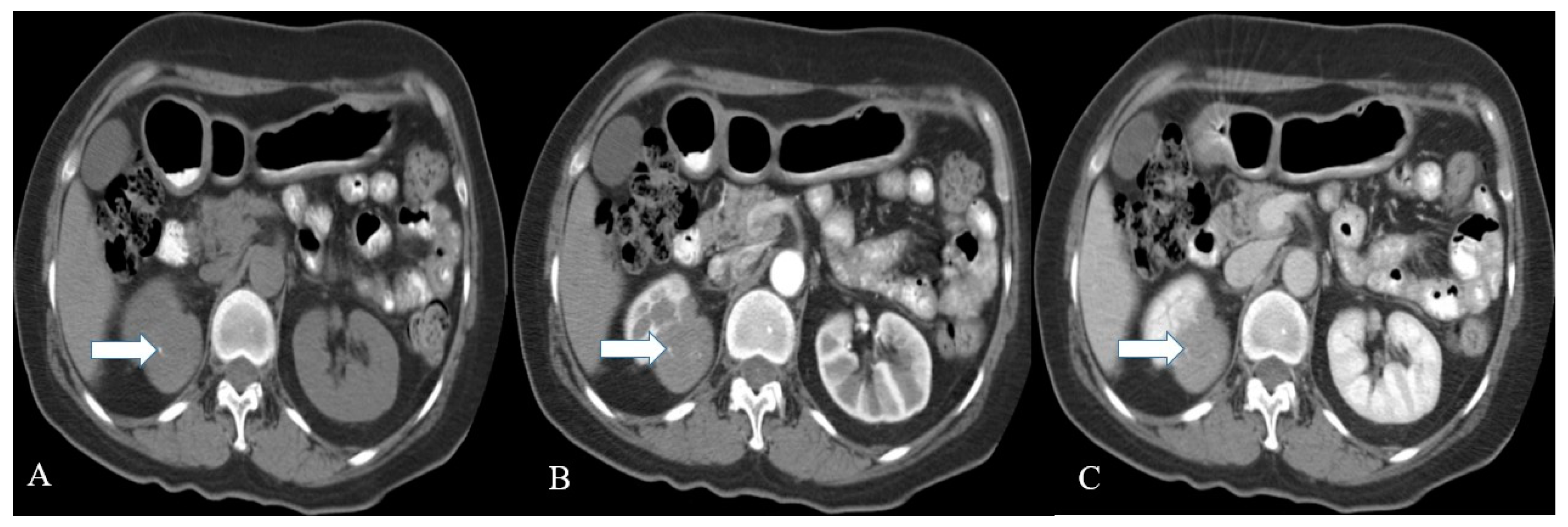 Cancers 14 03218 g005 Cancers 14 03218 g005