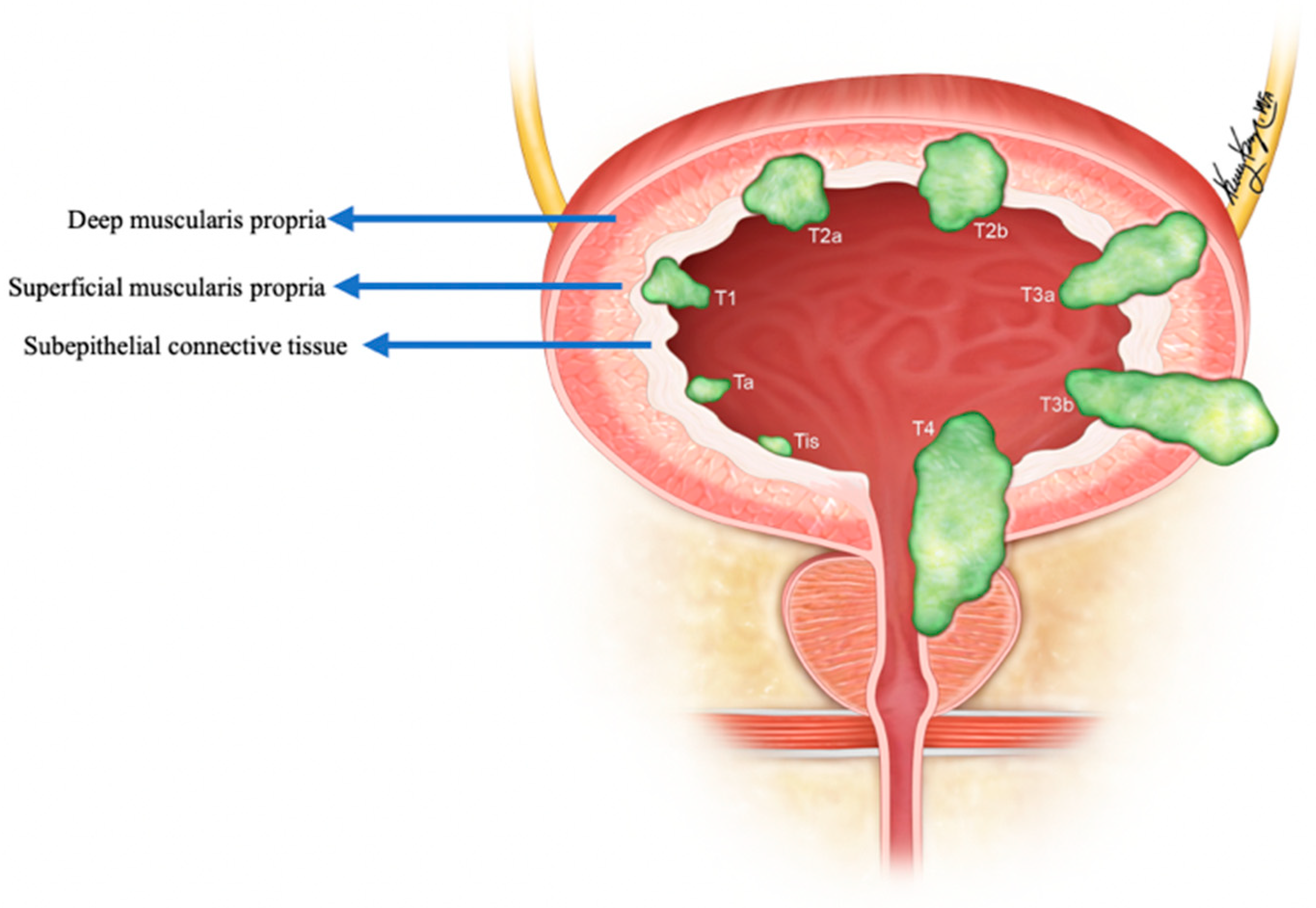 Cancers 14 03218 g011 Cancers 14 03218 g011