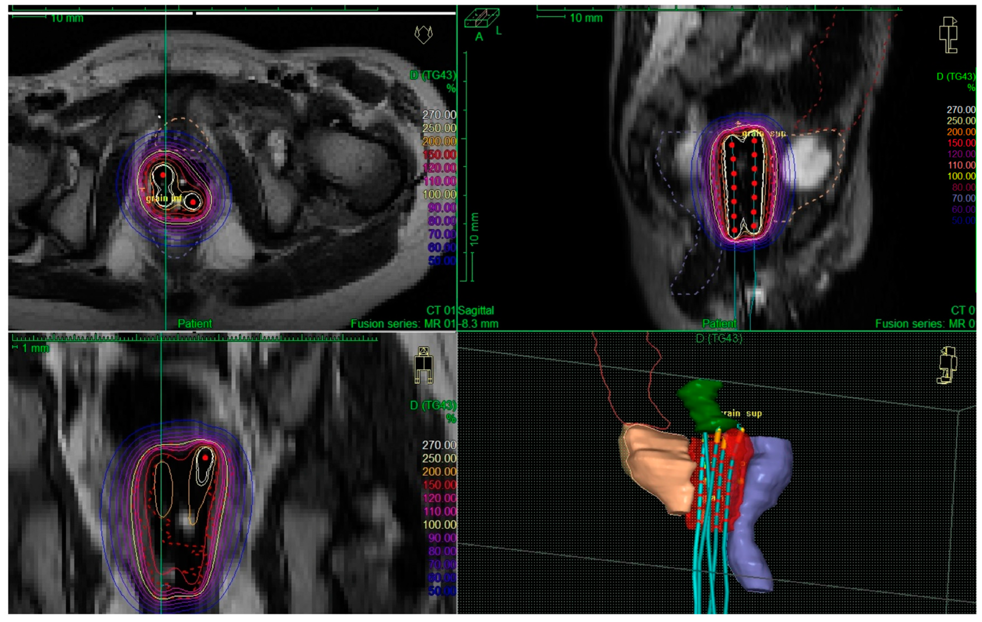 Cancers 14 03247 g001 550