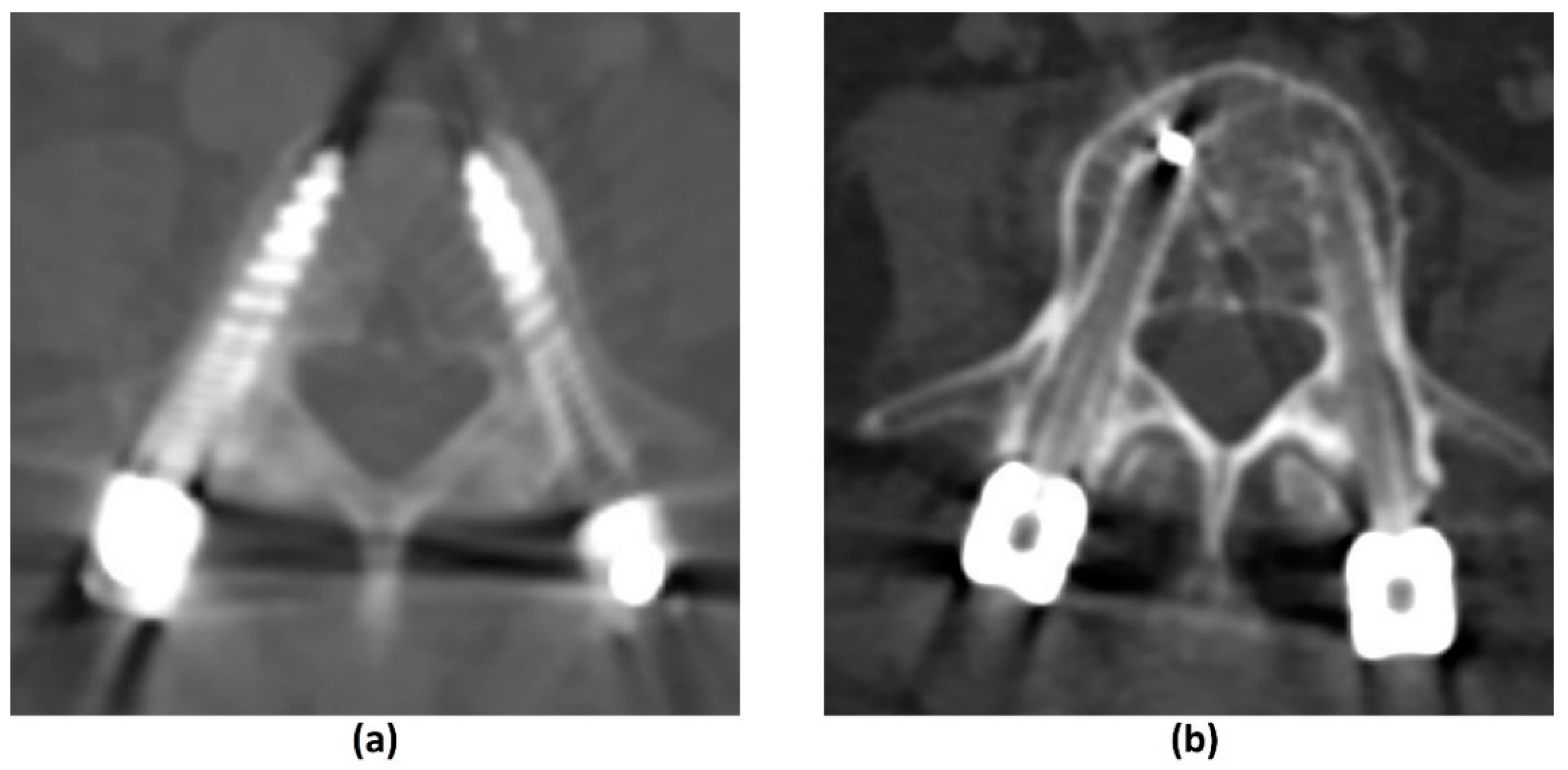TITANIUM SCREWS SET FOR X-RAY T4-2014 (95) TITANIUM SCREWS SET FOR X-RAY T4-2014 (95)