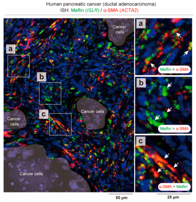 Cancers 14 03315 g003
