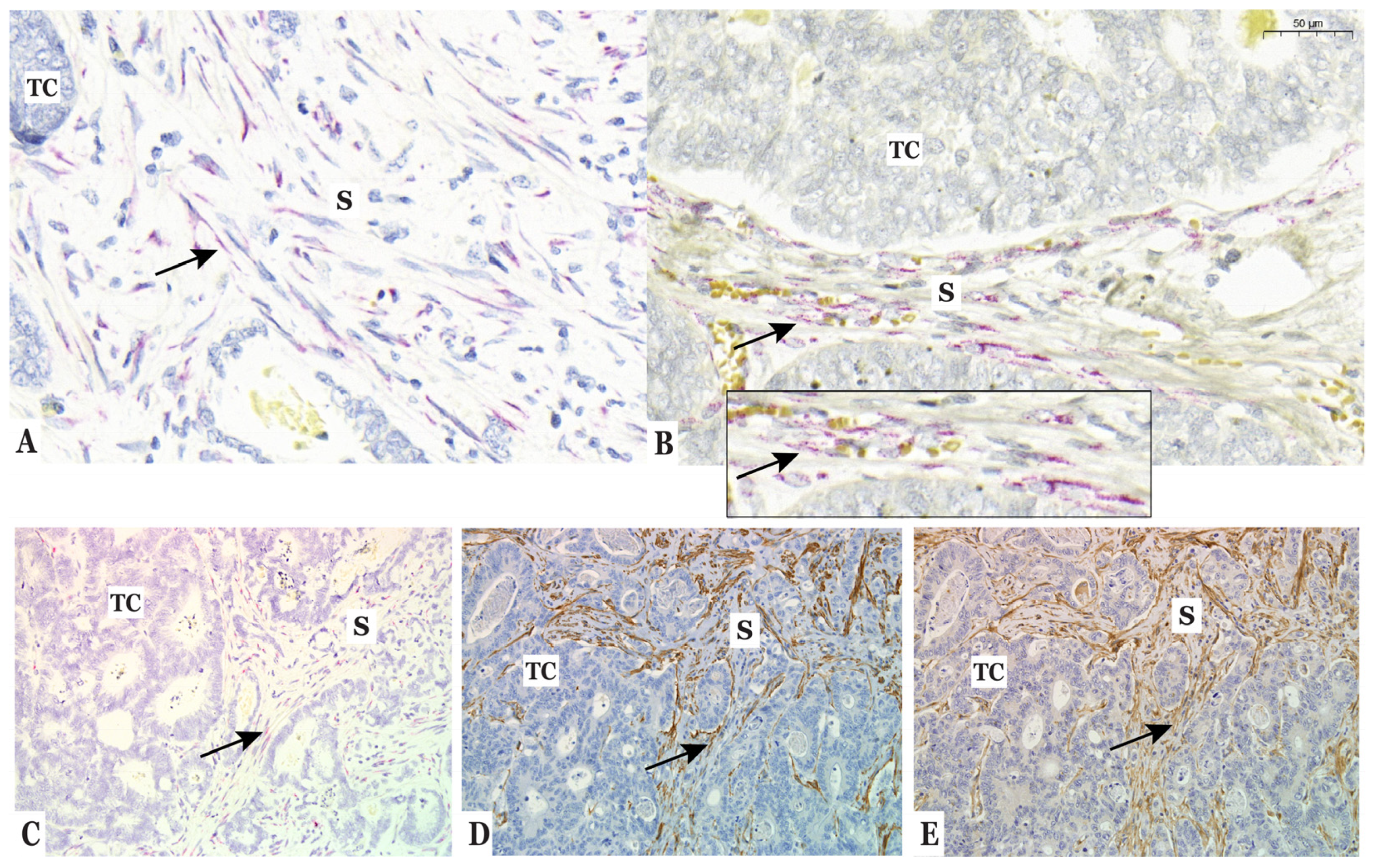 Cancers 14 03396 g002 Cancers 14 03396 g002