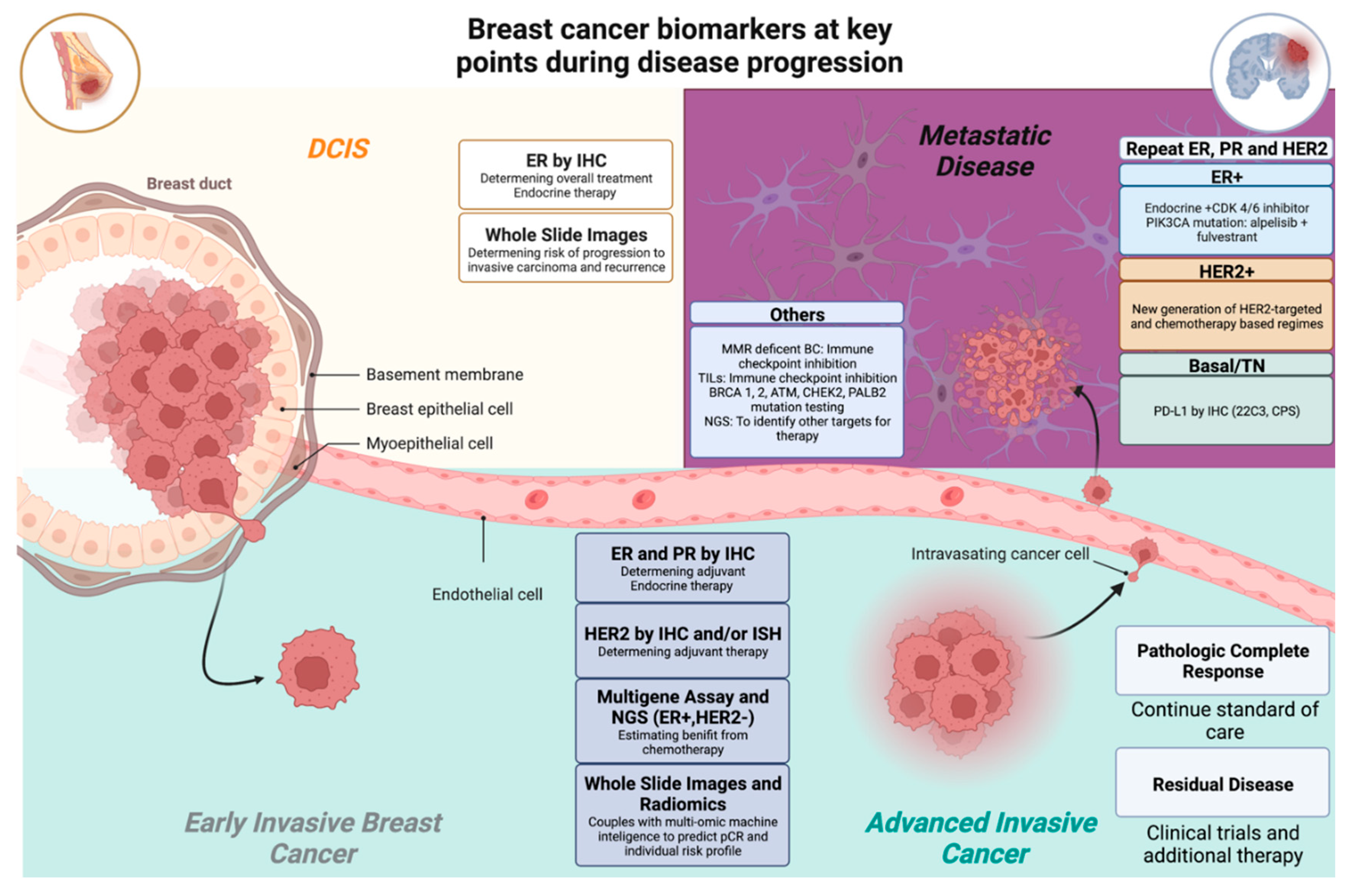 Study provides new look at why rare cancer often evades treatments