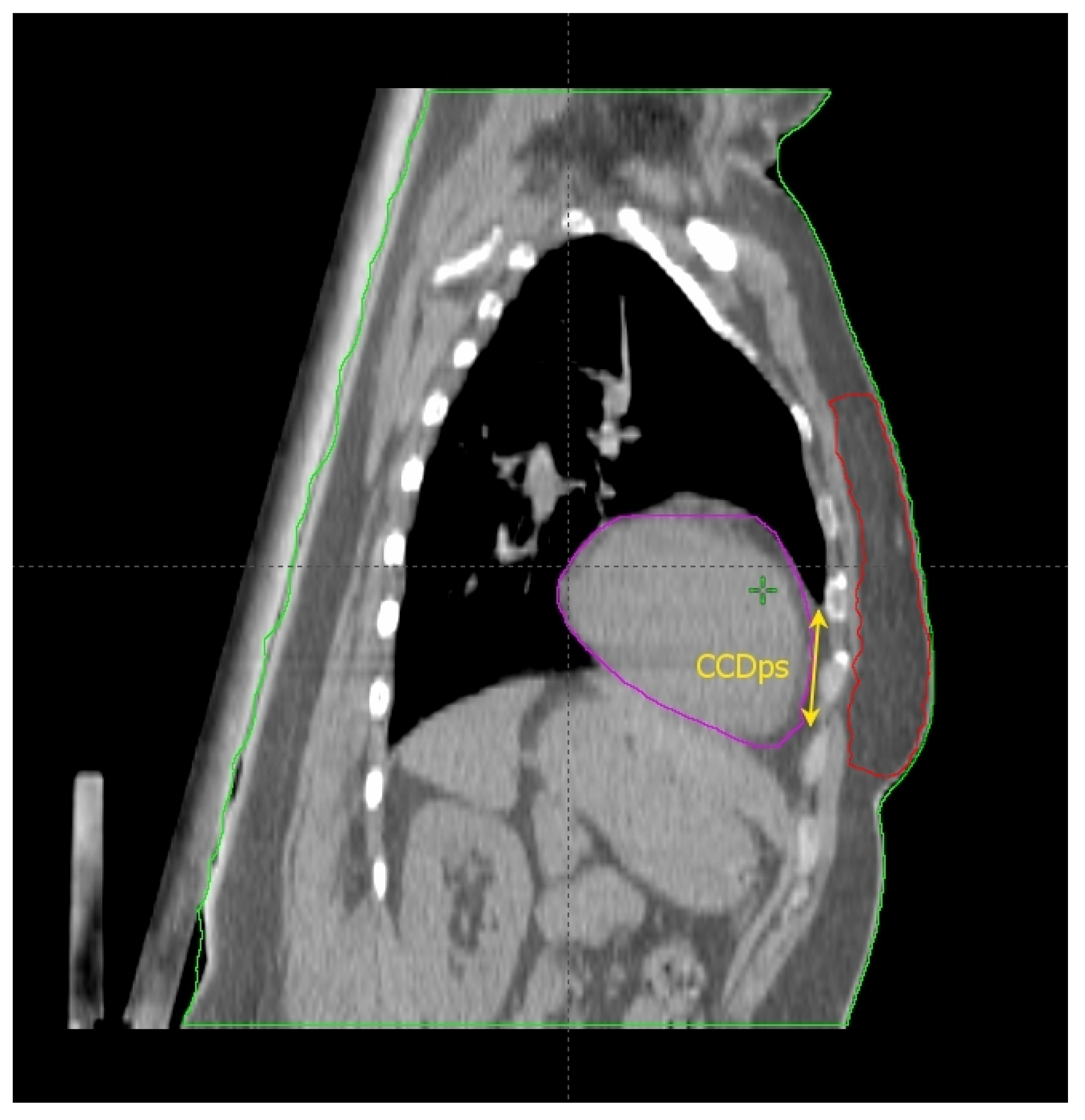 Cancers 14 03477 g002