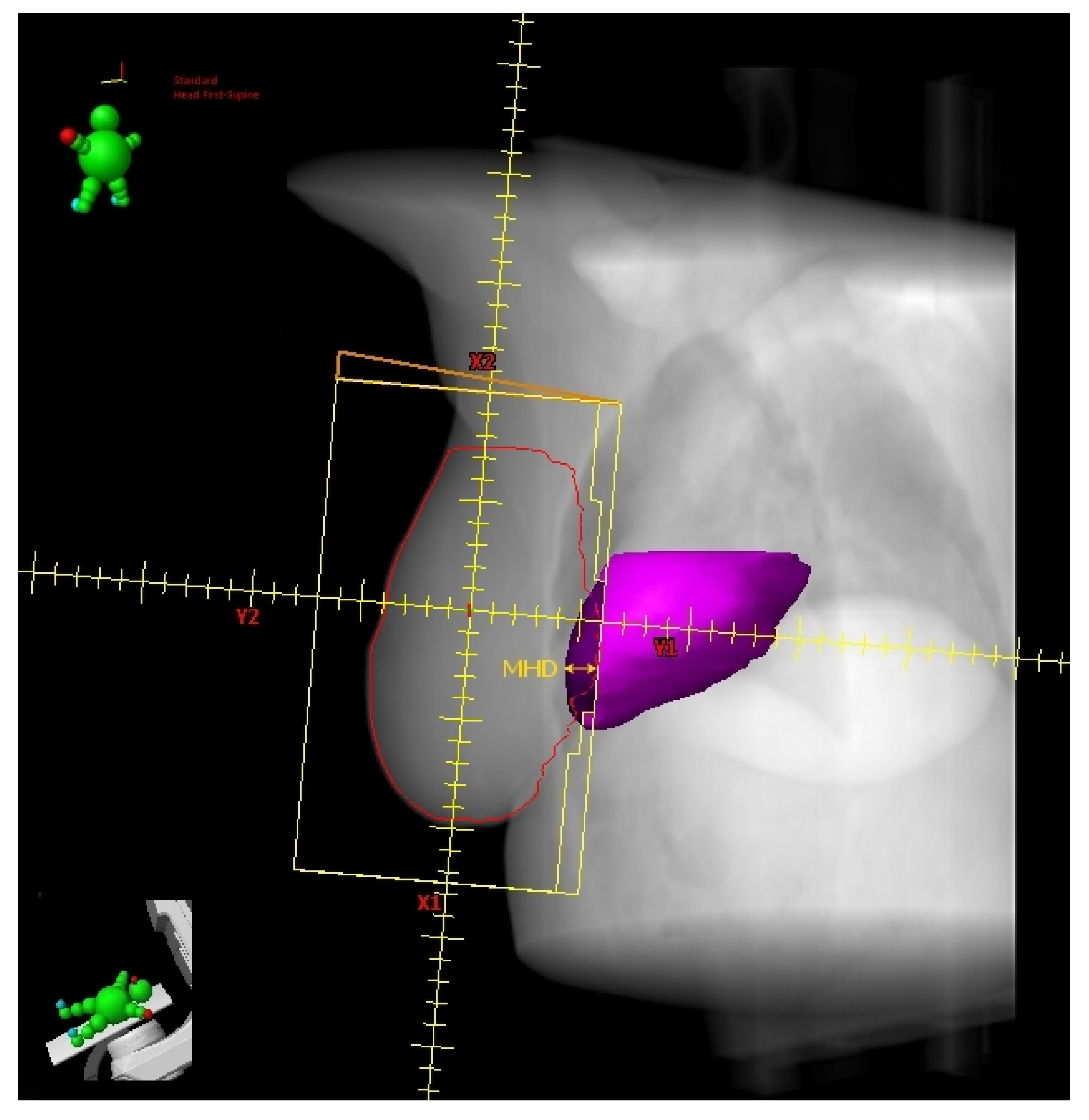 Cancers 14 03477 g003