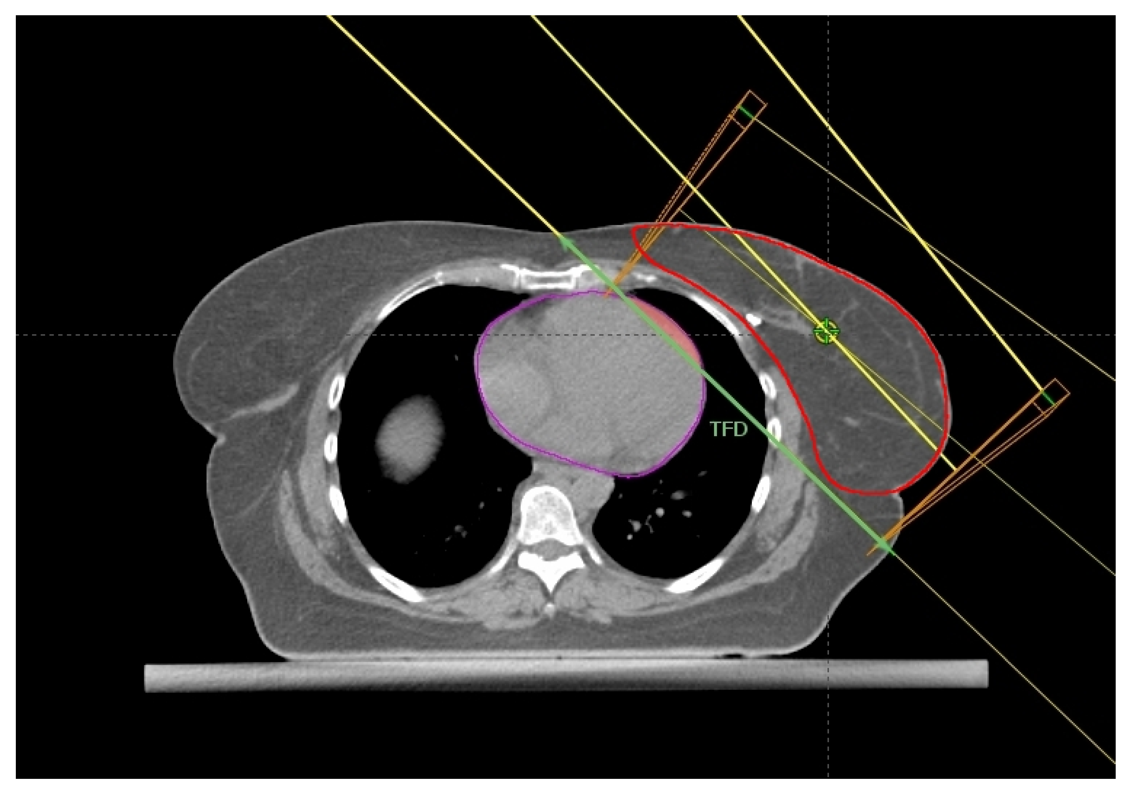 Cancers 14 03477 g004
