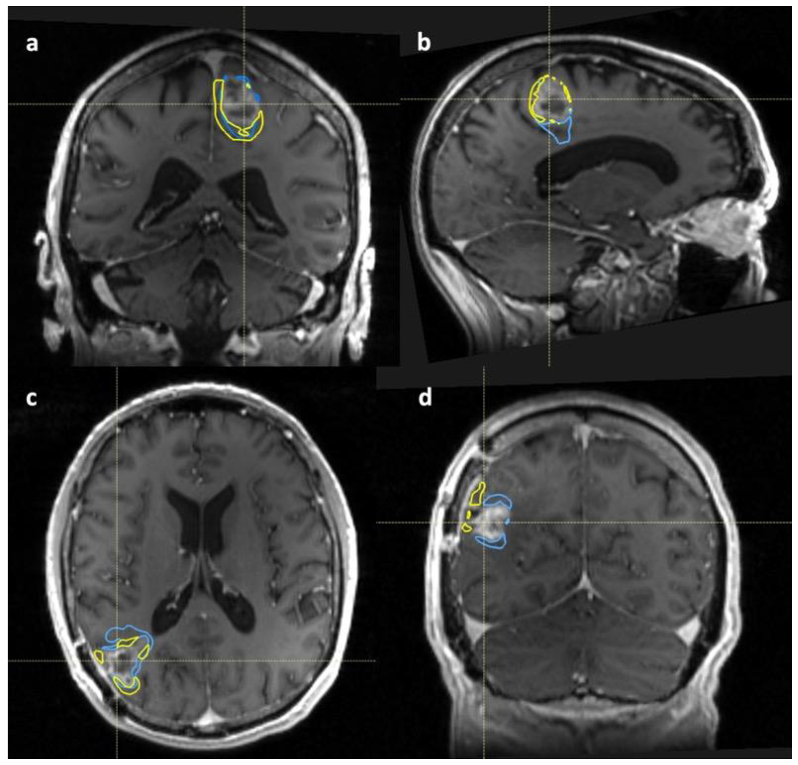 Cancers 14 03485 g004 550