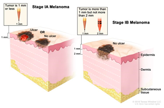 Cancers 14 03535 i002