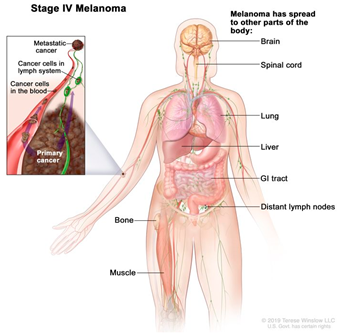 Cancers 14 03535 i004