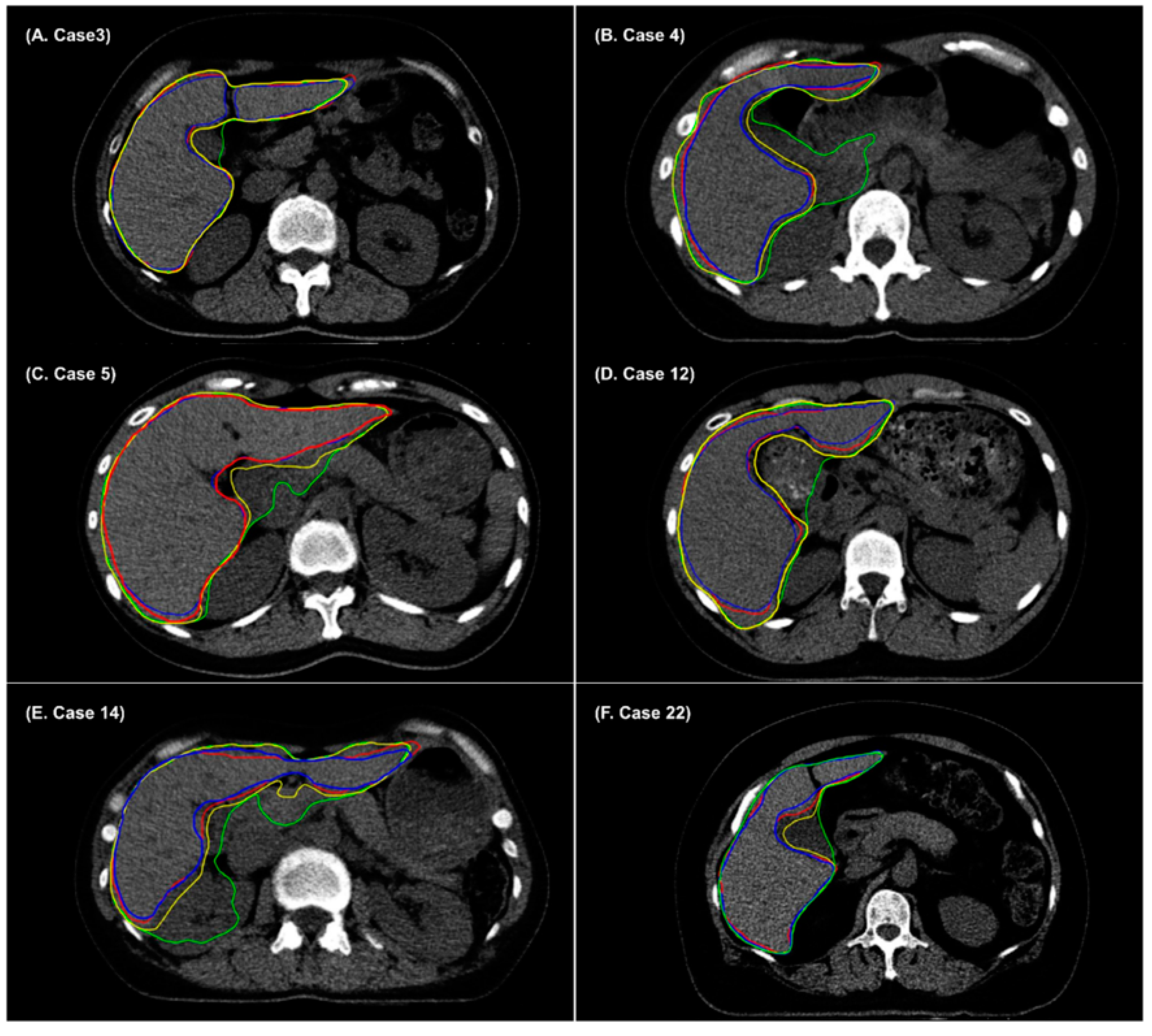 Cancers 14 03581 g003 550