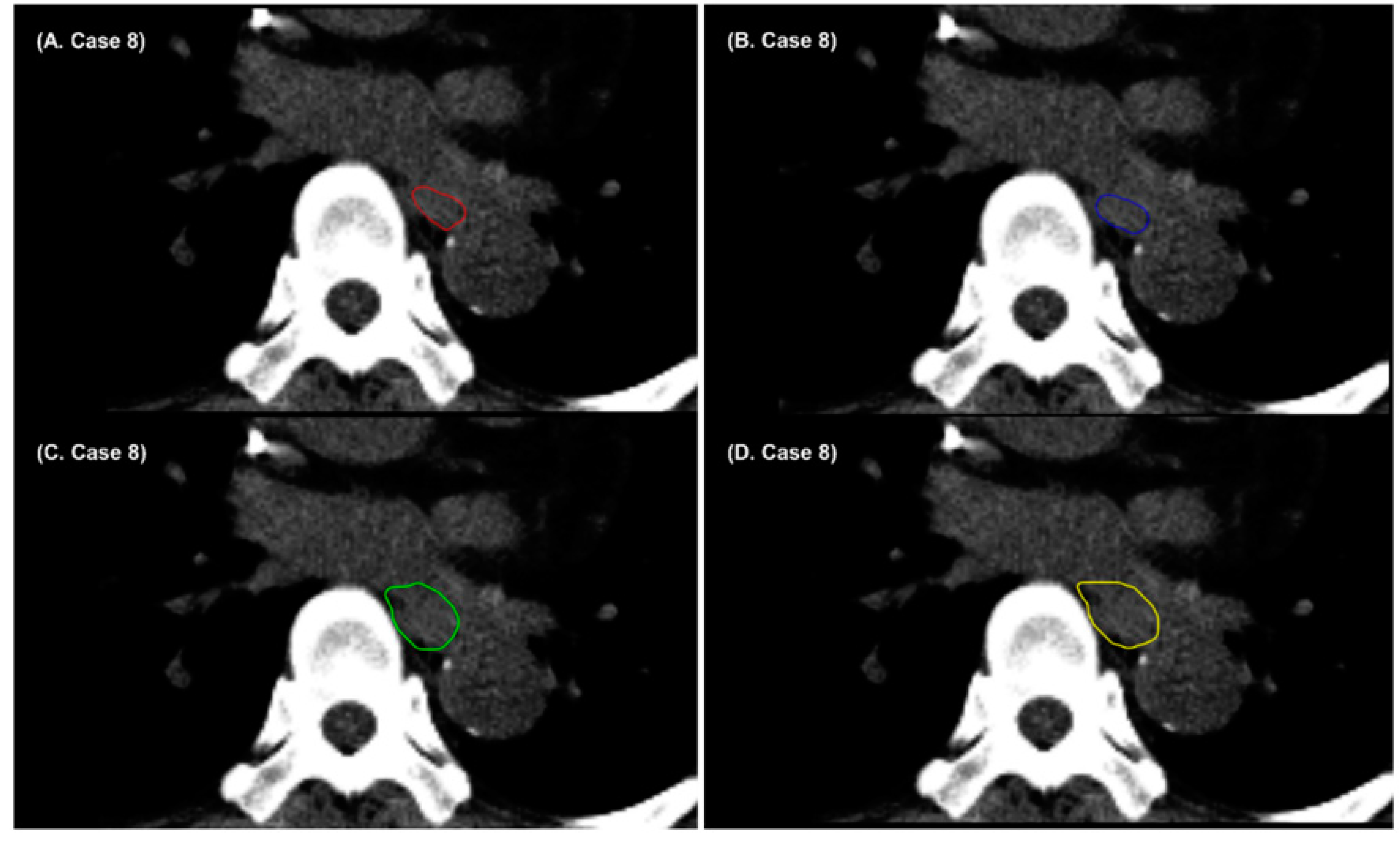 Cancers 14 03581 g004 550