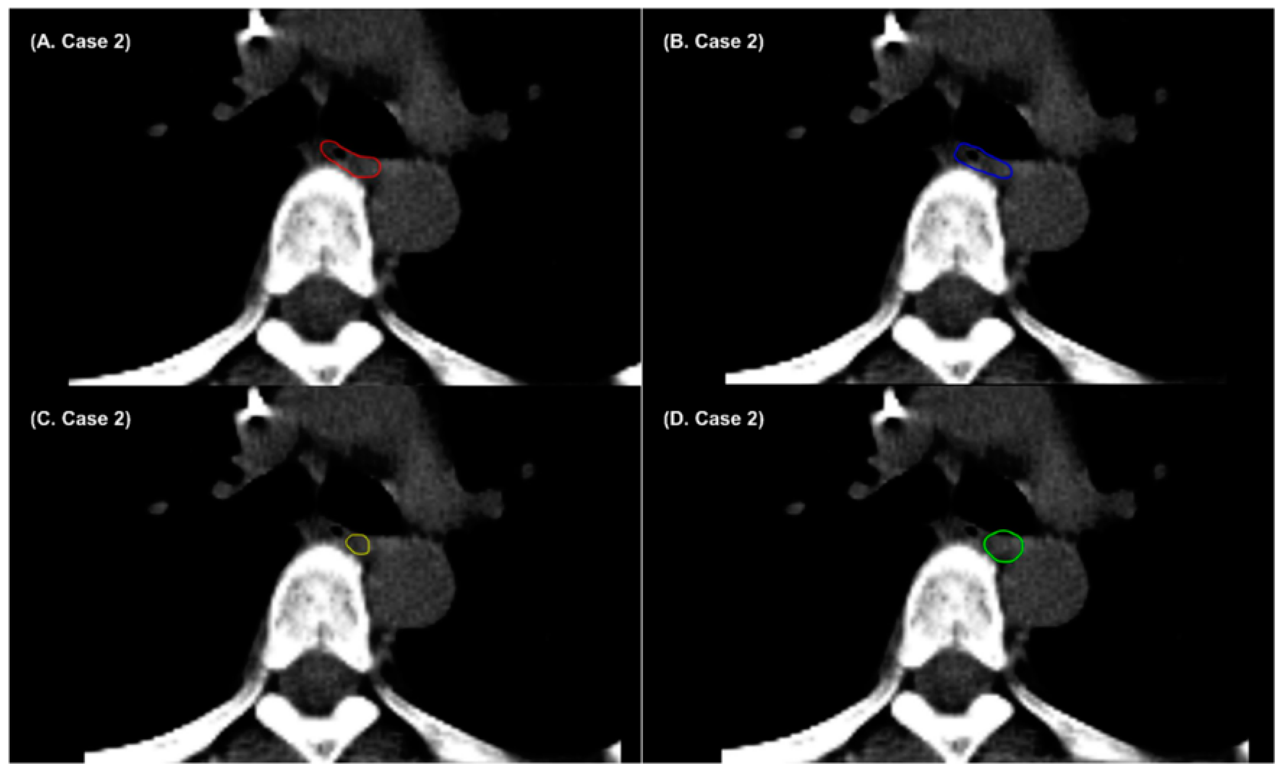 Cancers 14 03581 g005 550