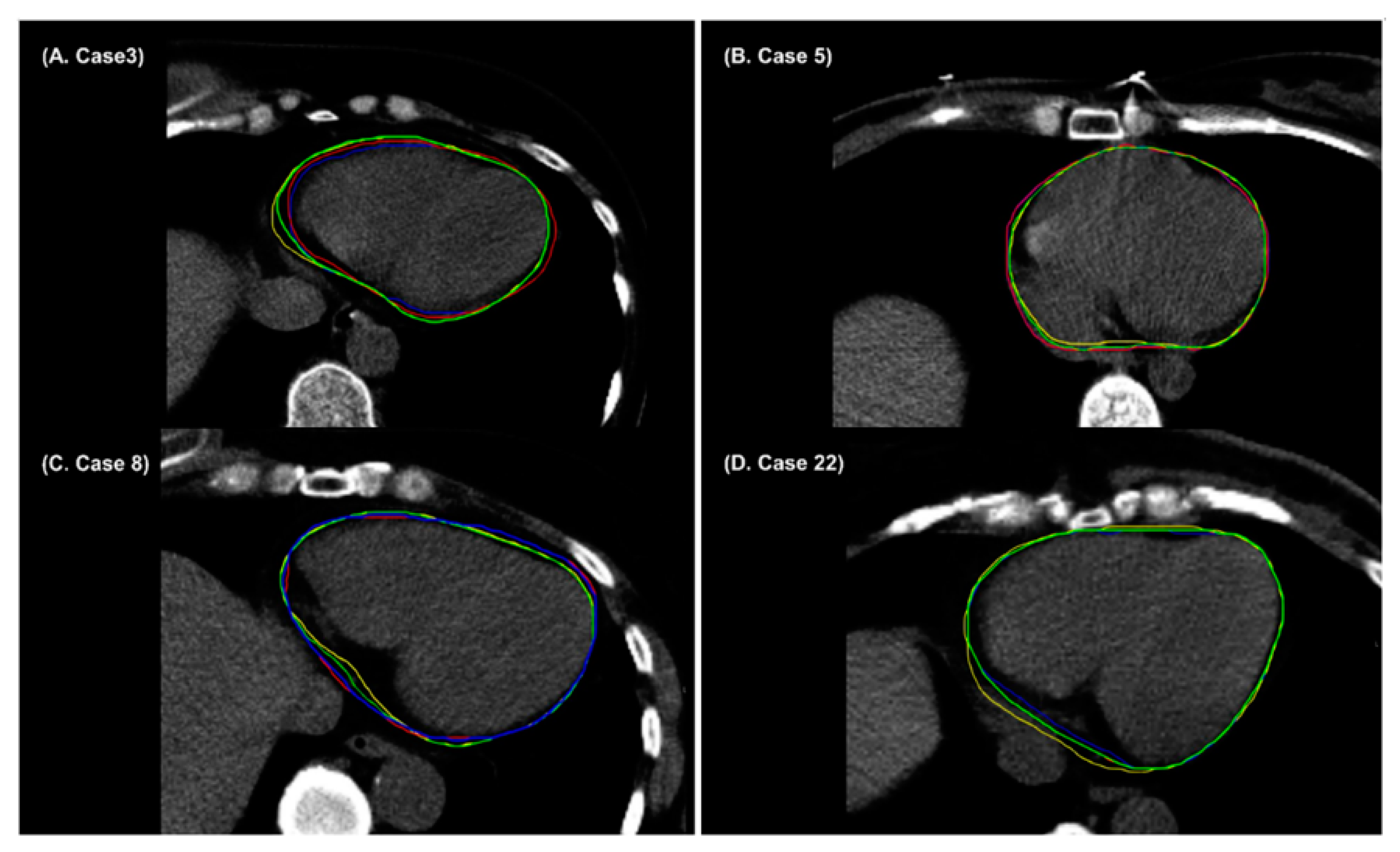 Cancers 14 03581 g006 550