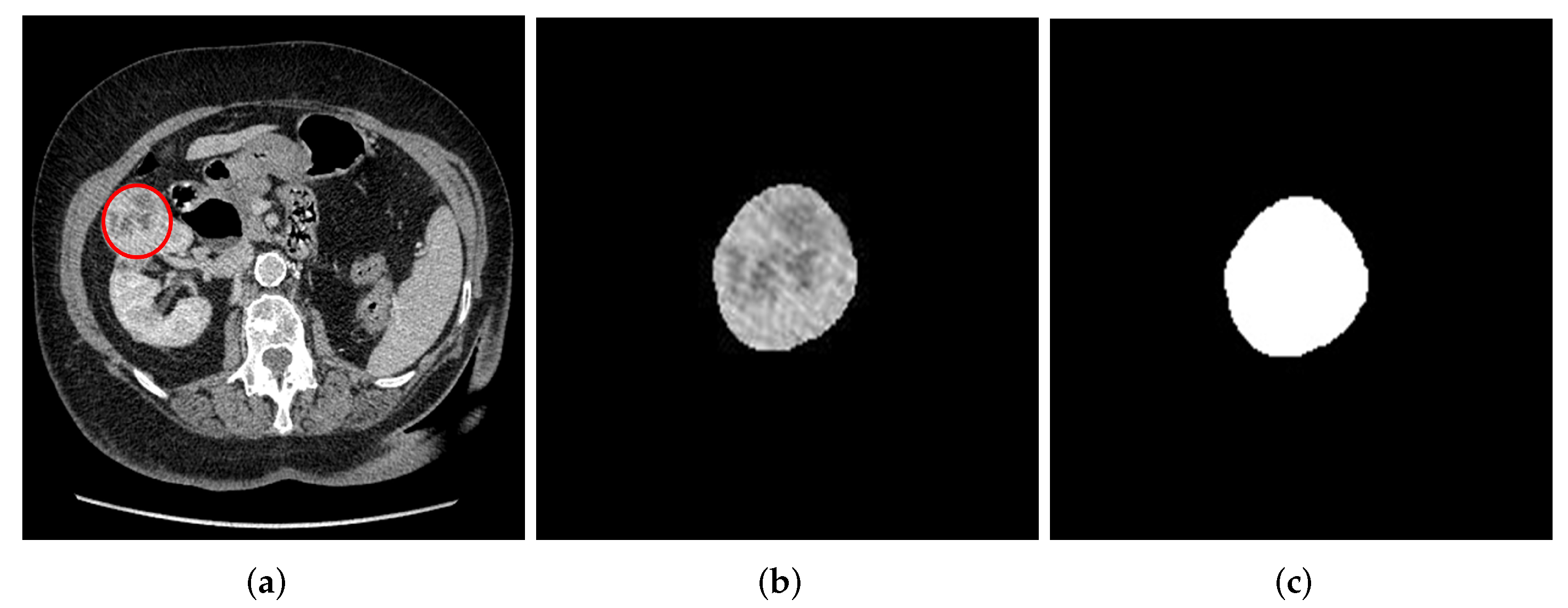 Cancers 14 03609 g001