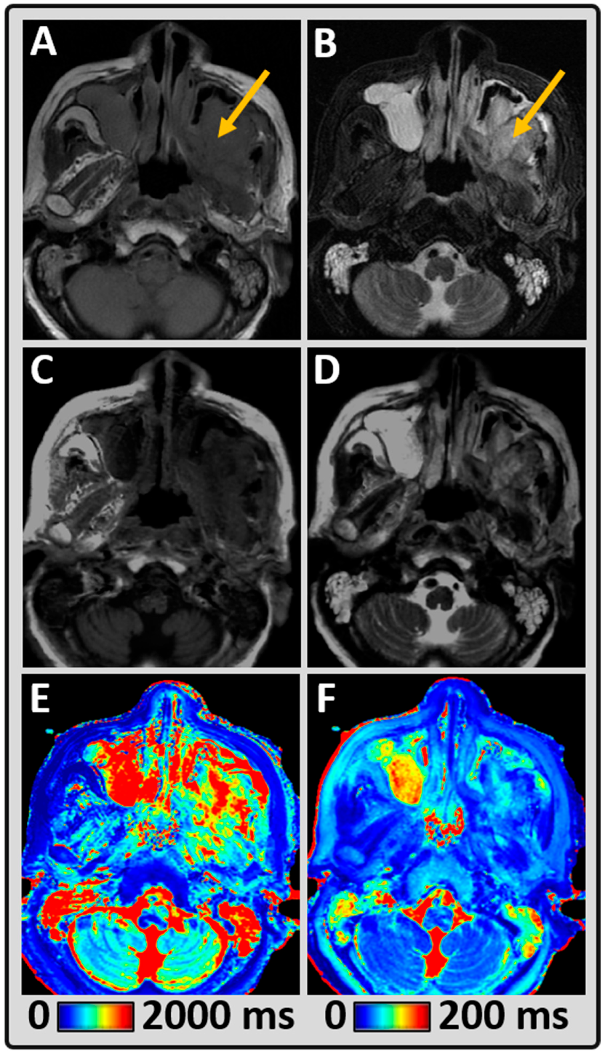 Cancers 14 03624 g003 Cancers 14 03624 g003