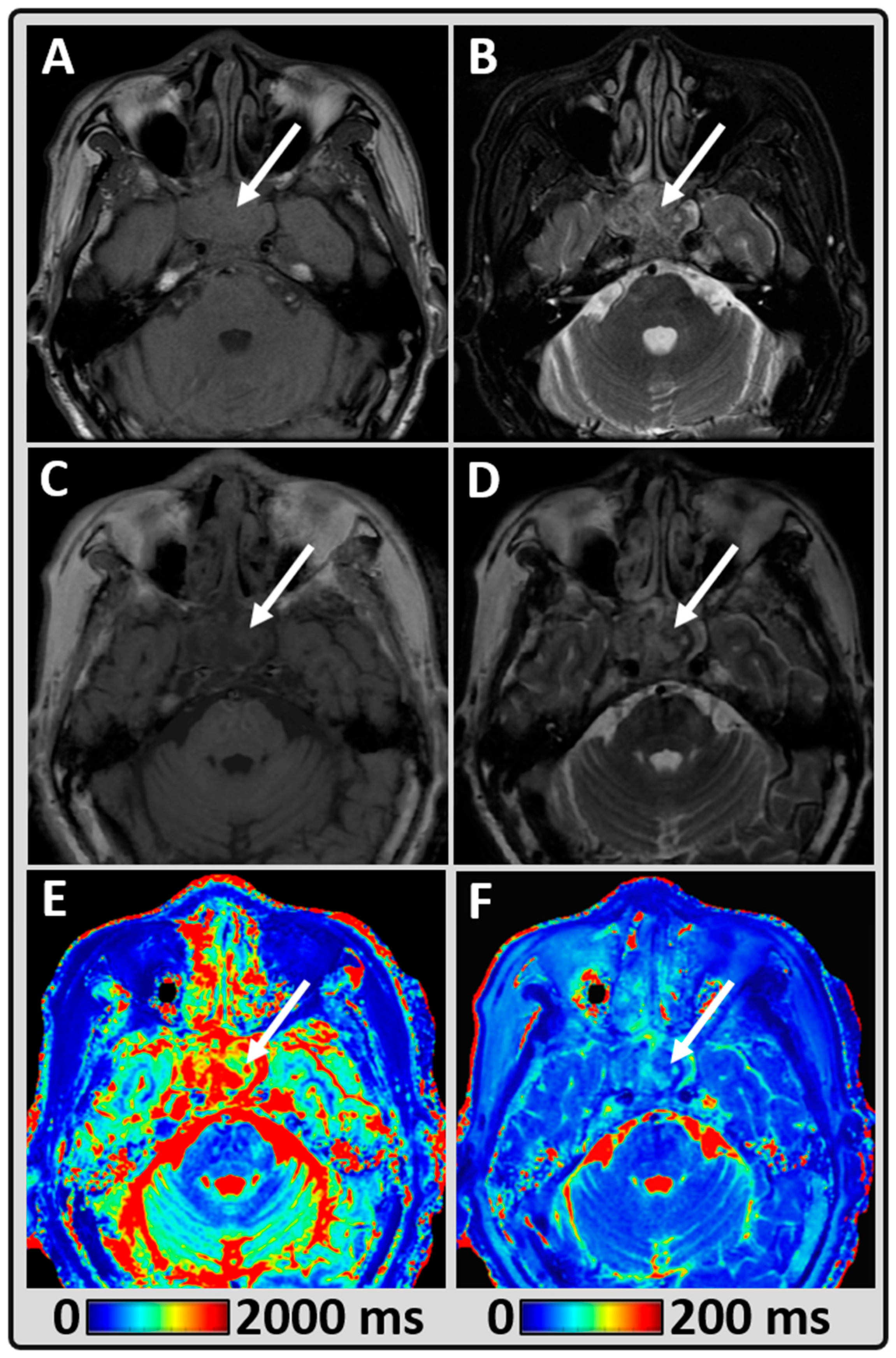 Cancers 14 03624 g004 Cancers 14 03624 g004