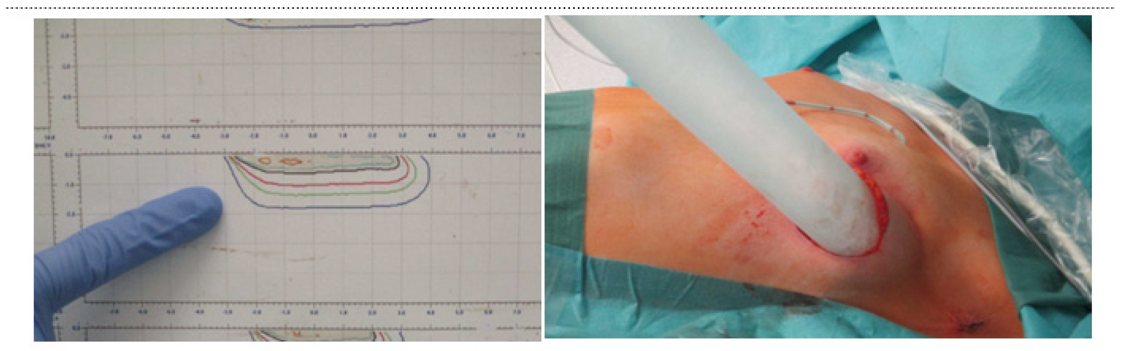 Cancers 14 03636 g003 550