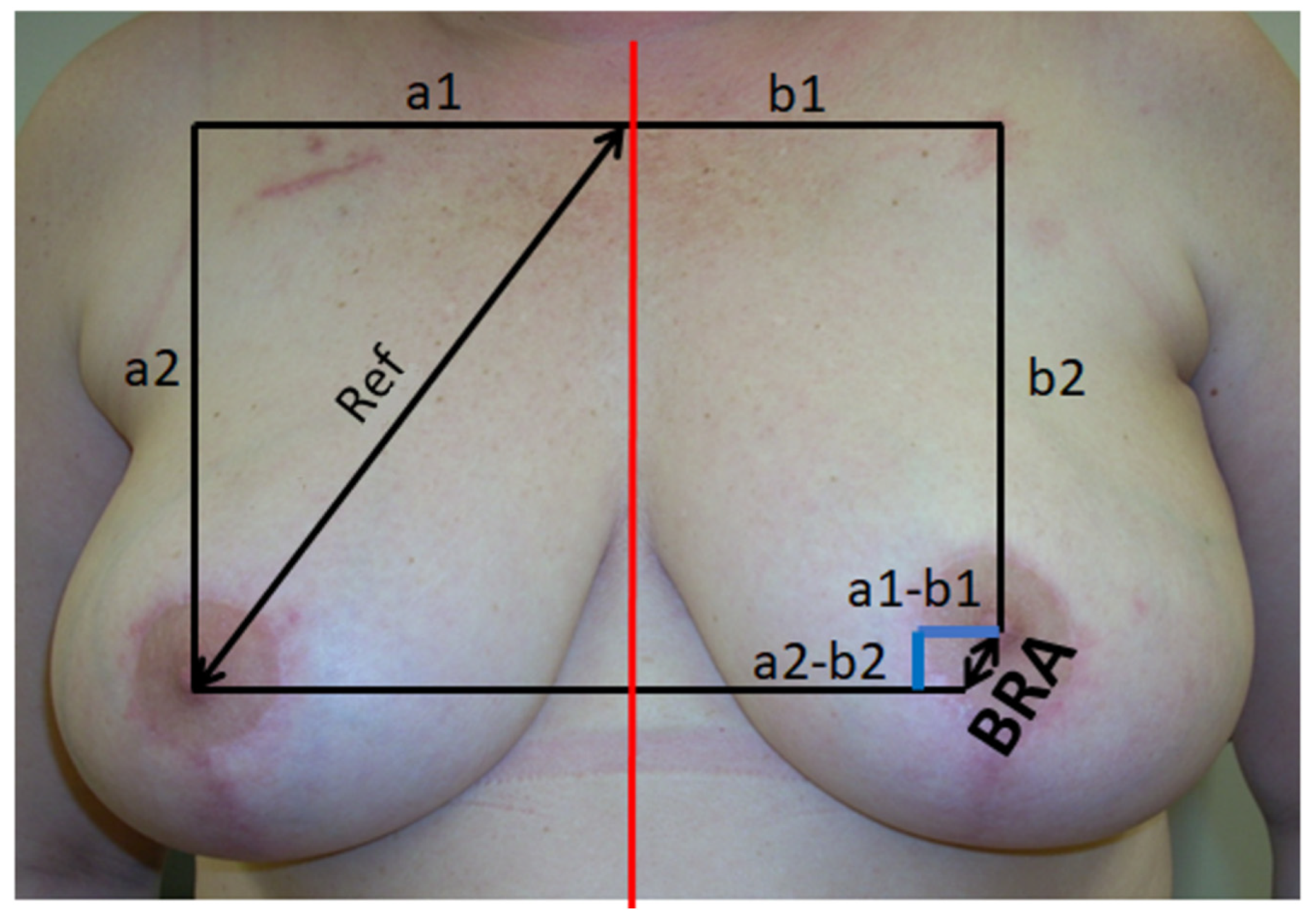 Cancers 14 03636 g004 550