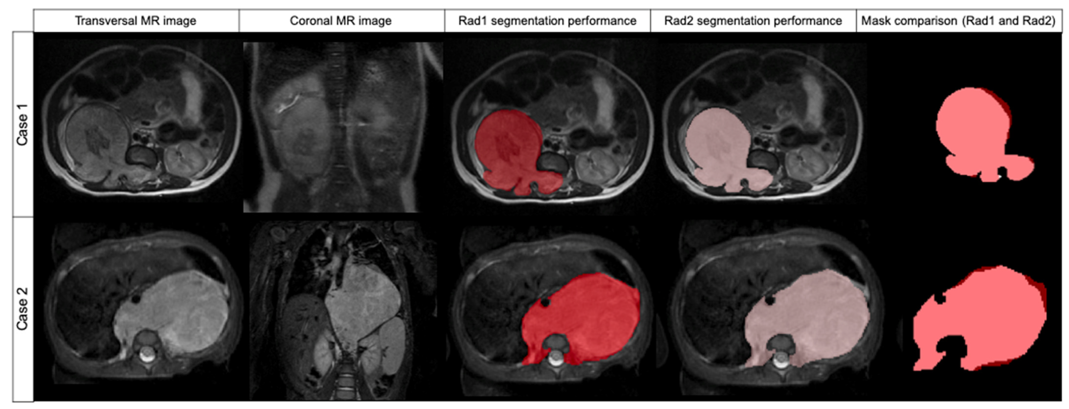 Cancers 14 03648 g003