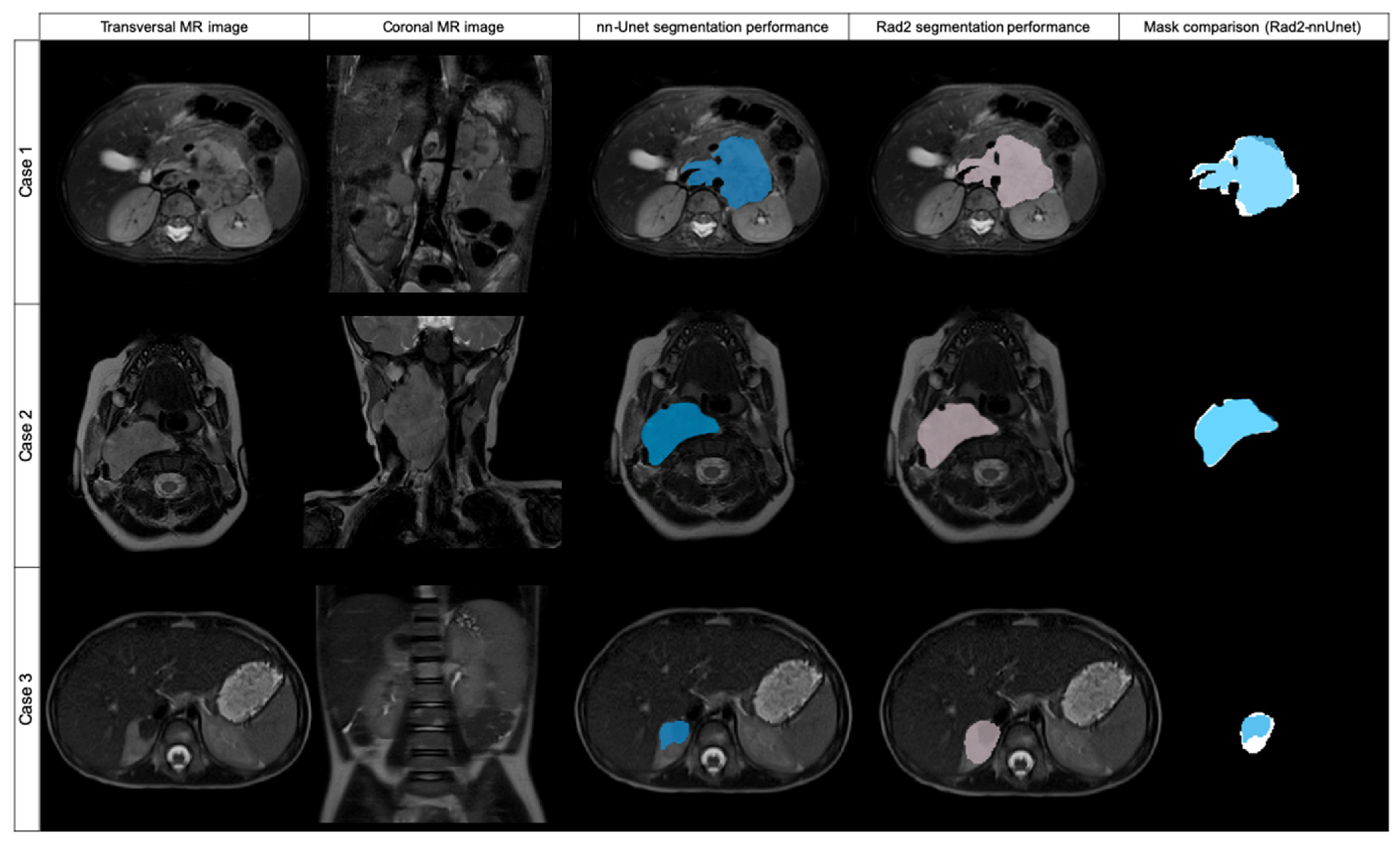 Cancers 14 03648 g004