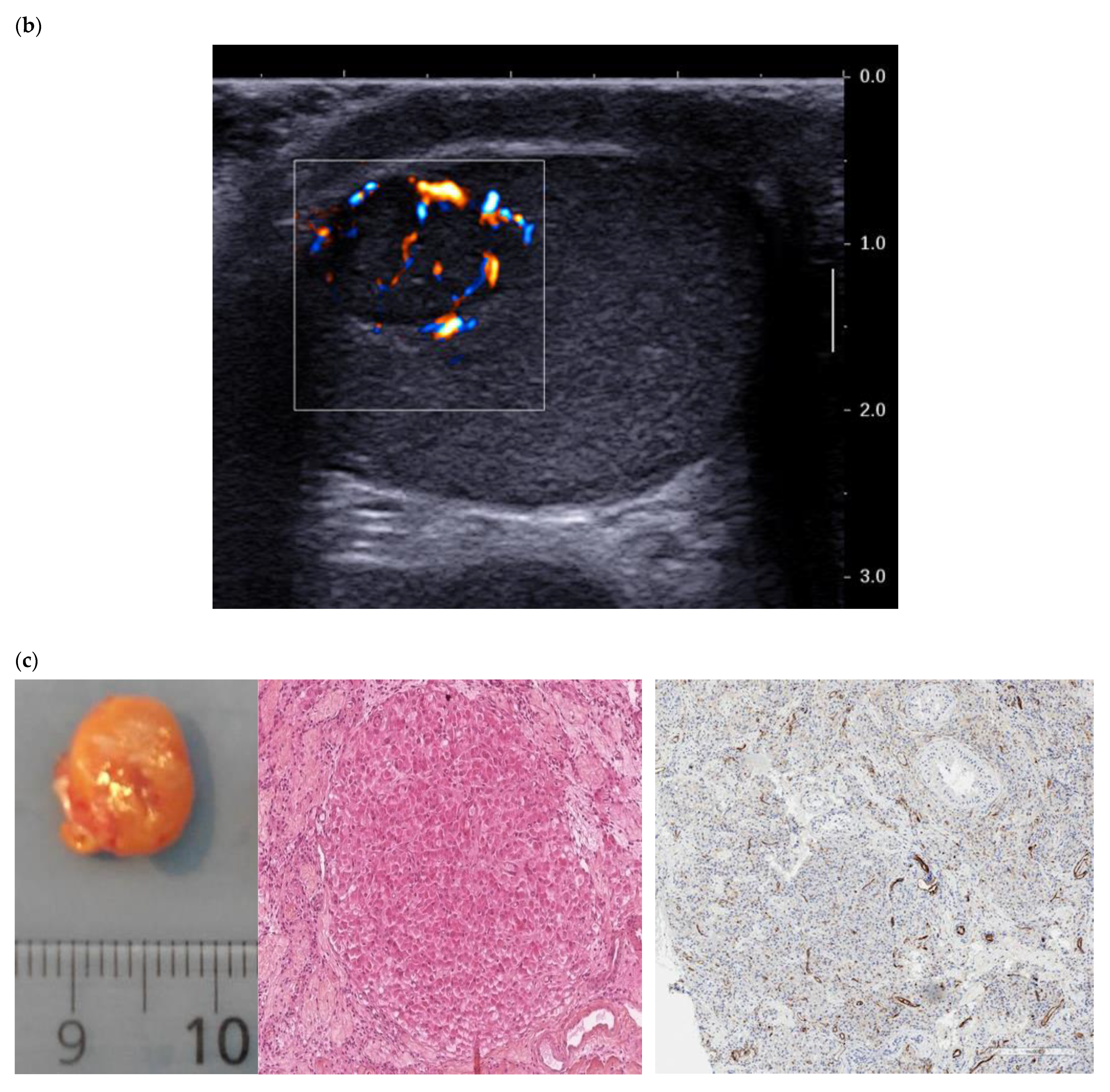 Cancers 14 03652 g001b