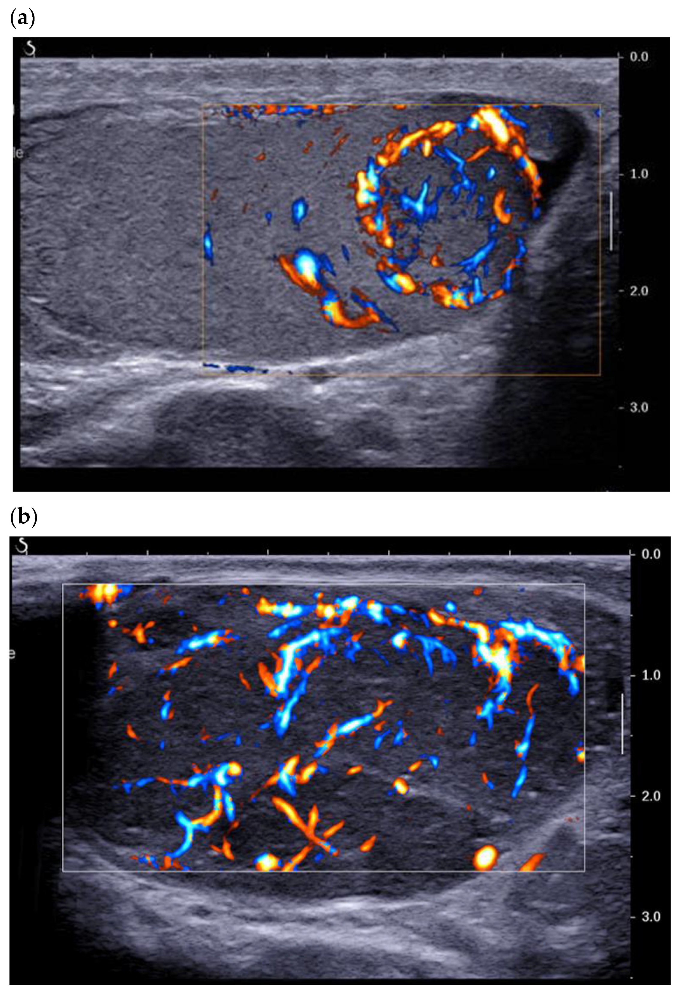 Cancers 14 03652 g003