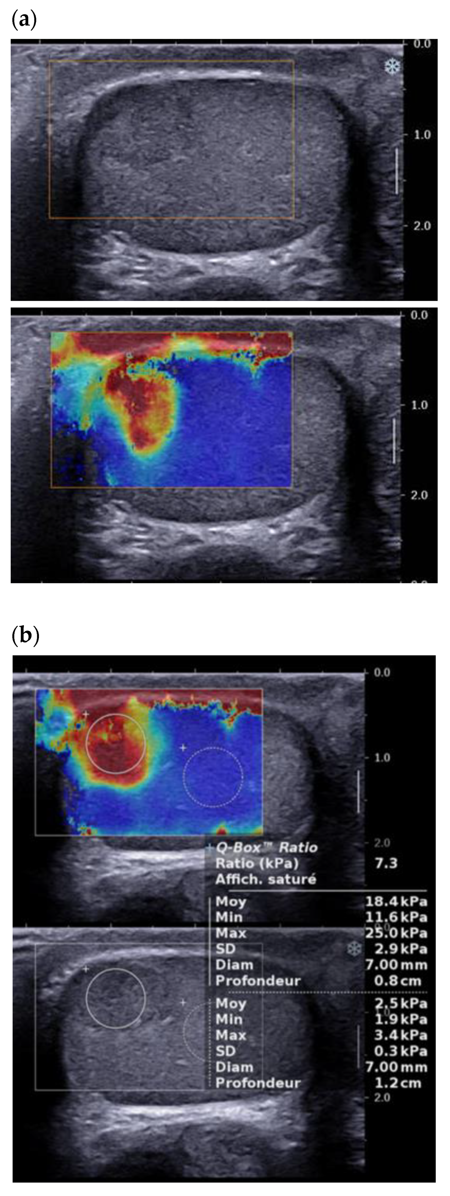 Cancers 14 03652 g005