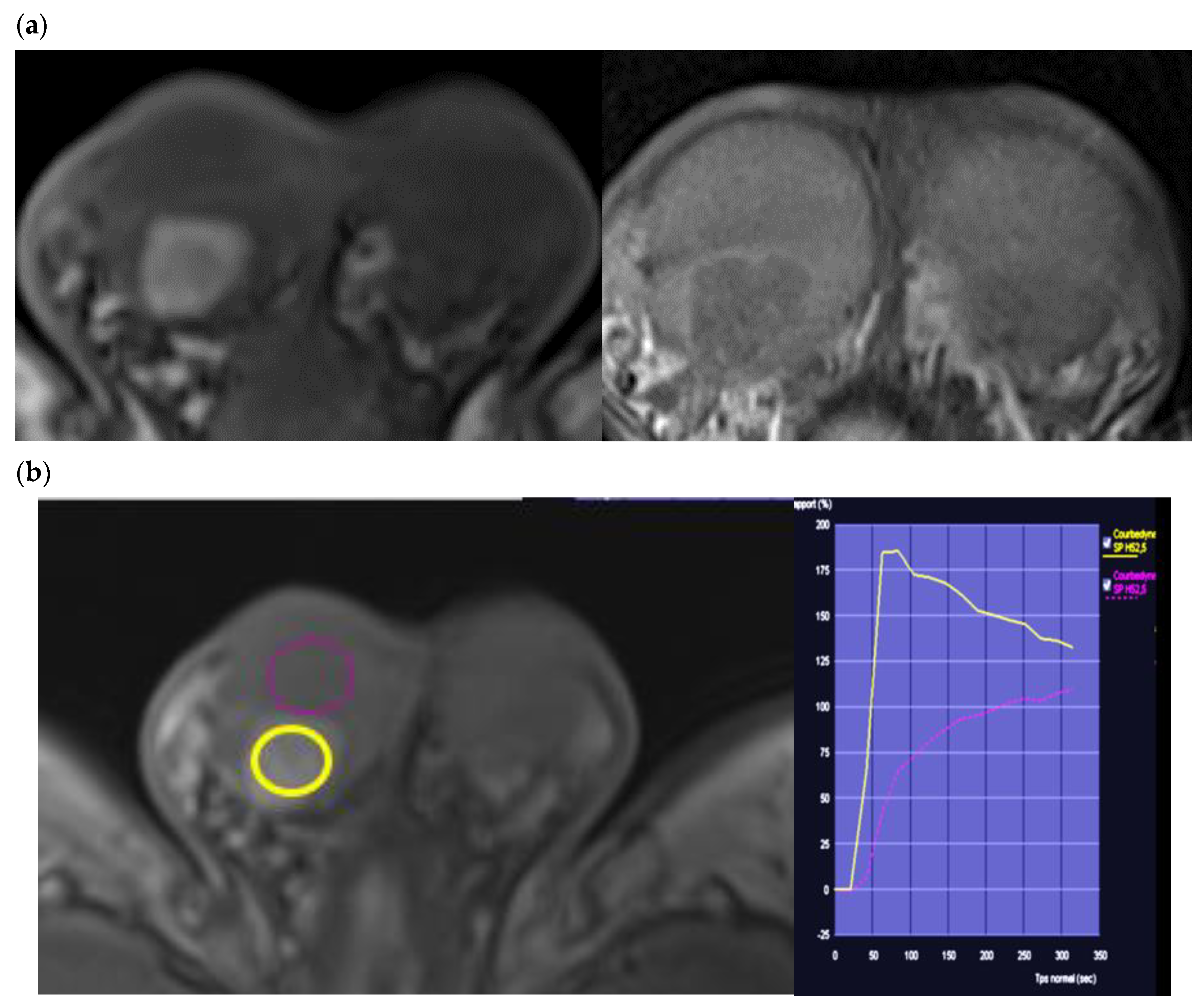 Cancers 14 03652 g008