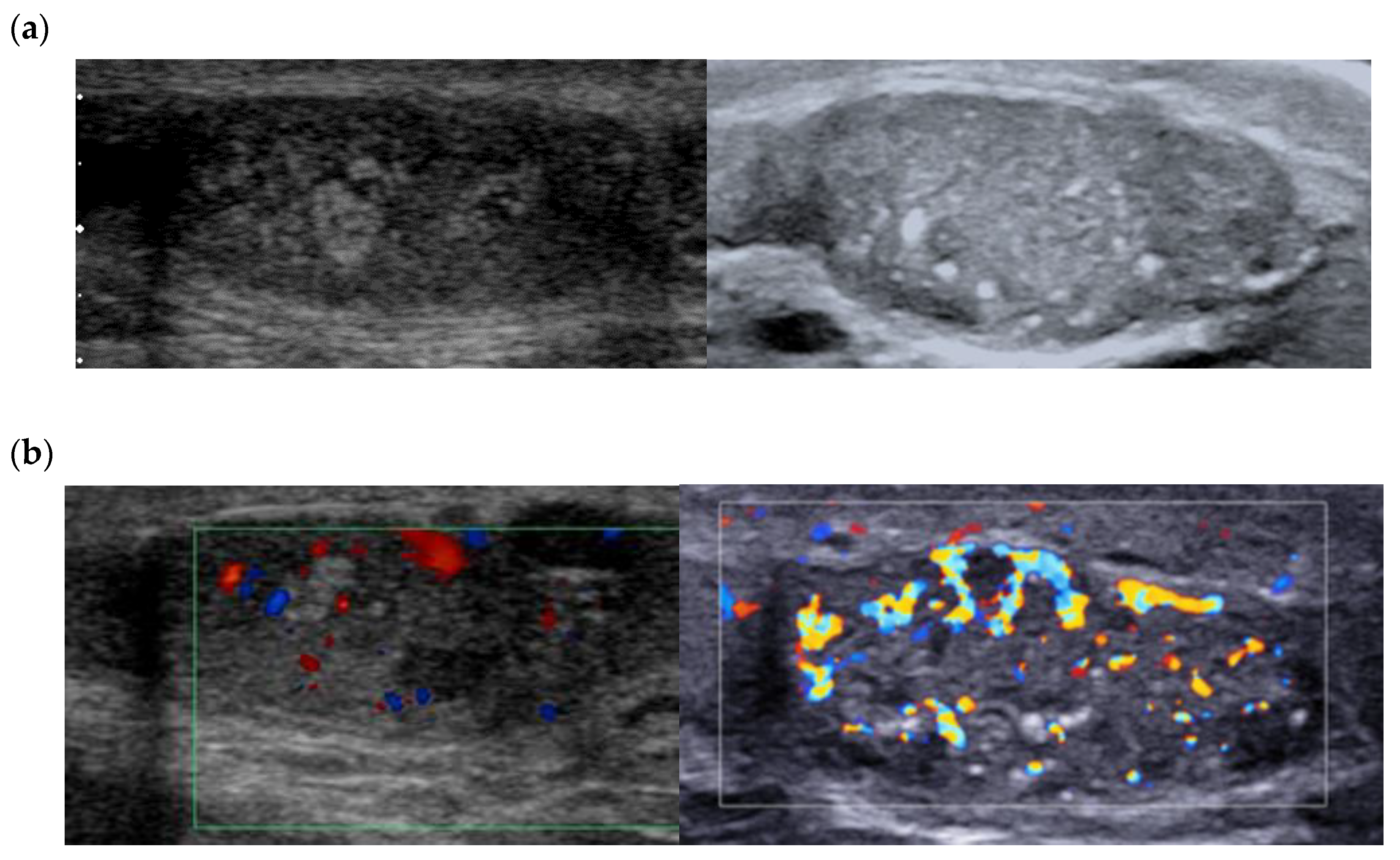 Cancers 14 03652 g009